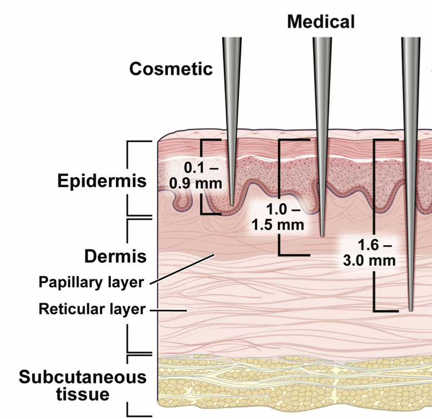 Best Skincare Treatments For Winter - treatment image