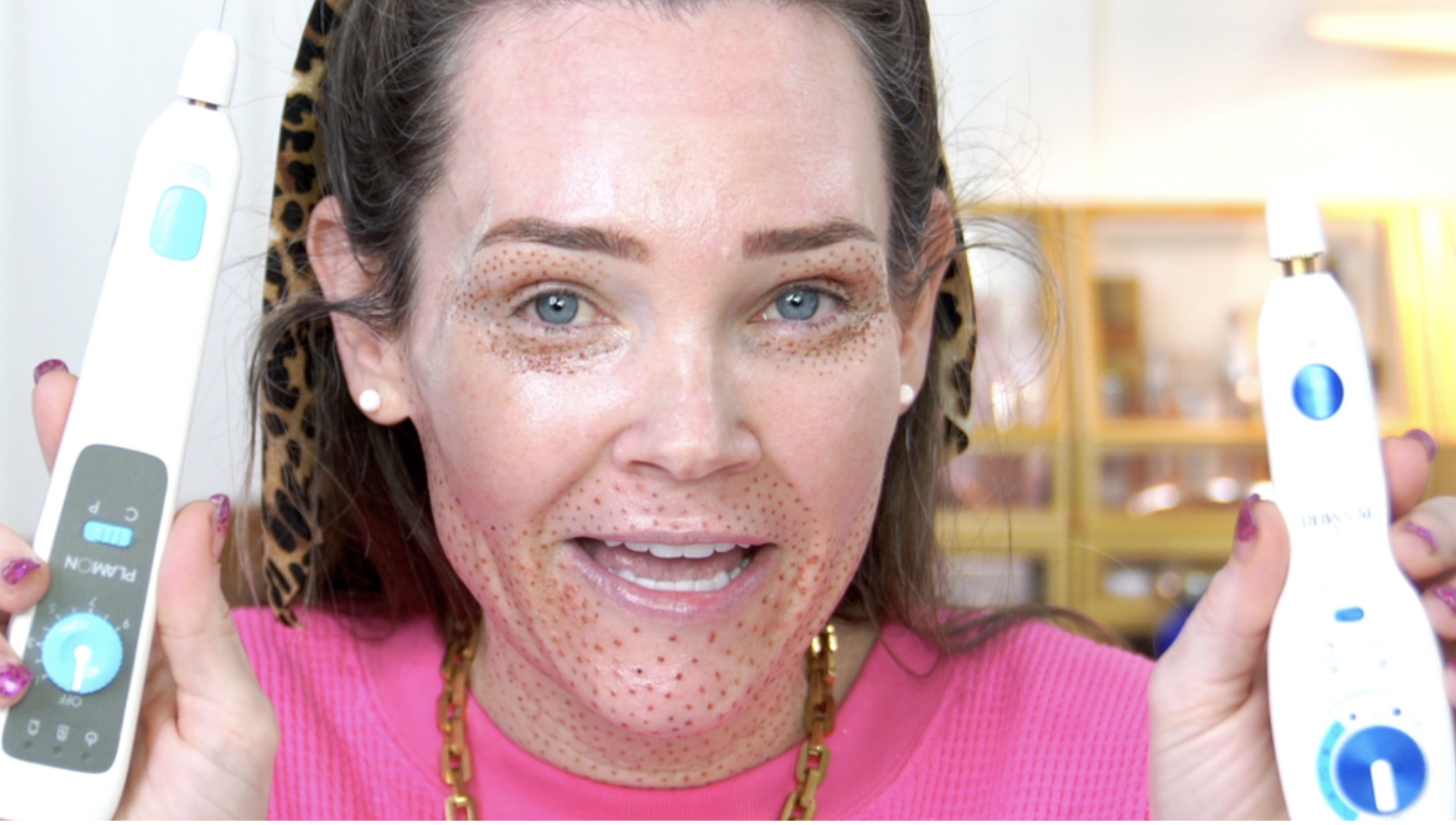 Best Skincare Treatments For Winter - treatment image