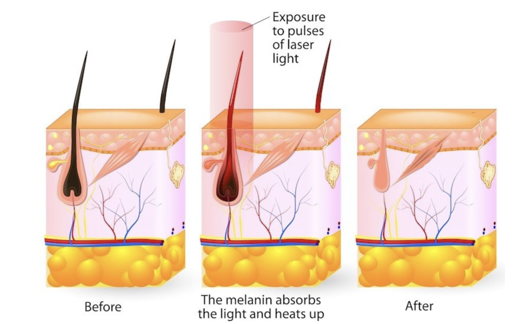 Best Skincare Treatments For Winter - treatment image