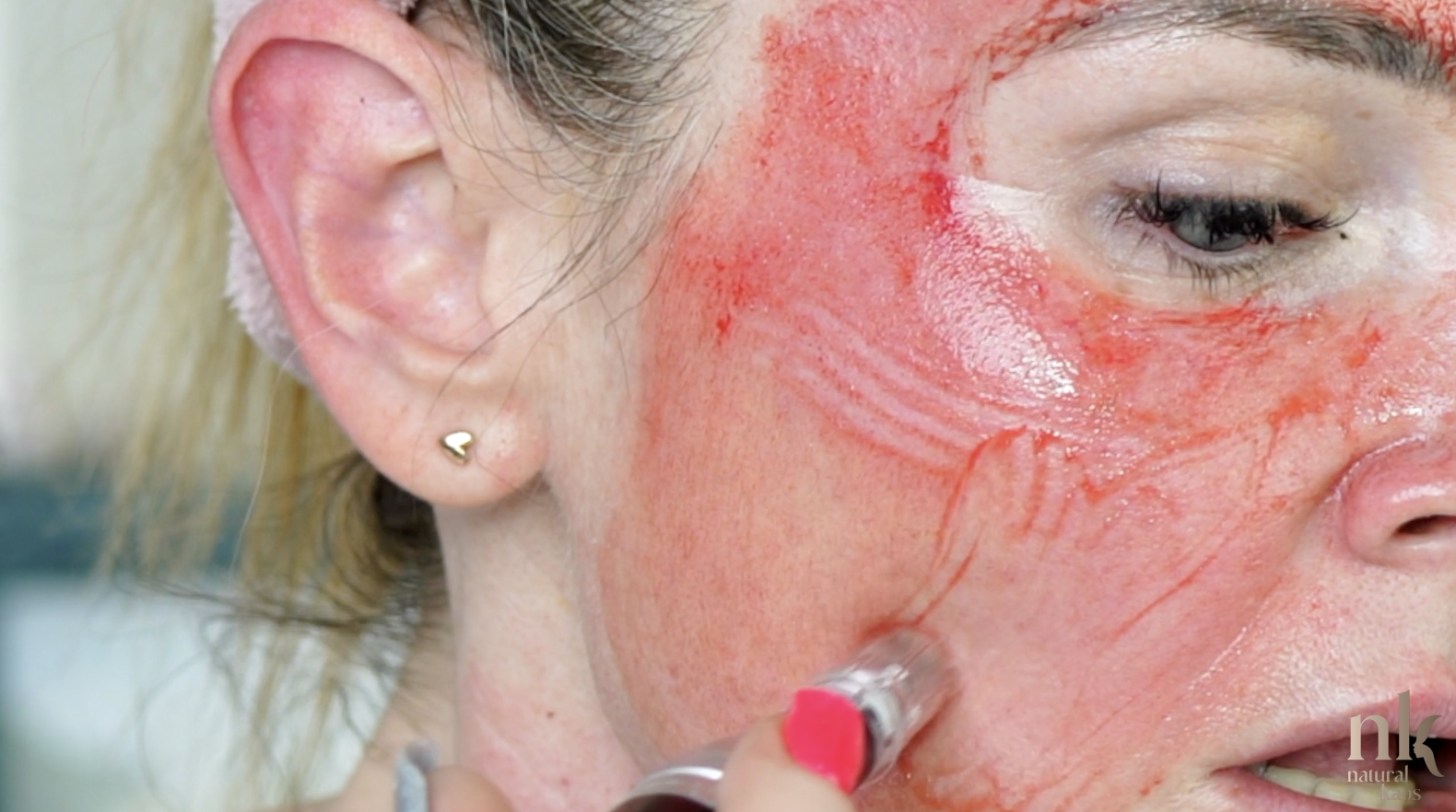 Best Skincare Treatments For Winter - treatment image