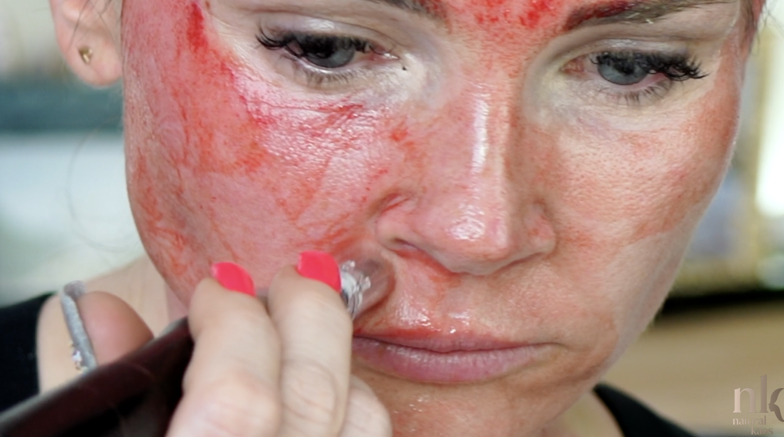 Best Skincare Treatments For Winter - treatment image