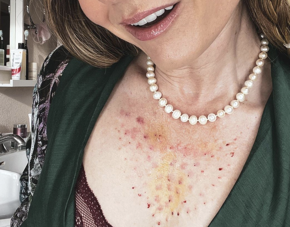 Charlotte Tilbury Makeup - treatment image
