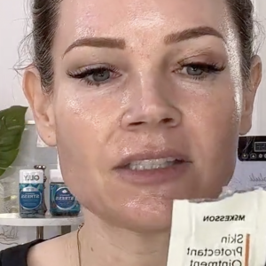 BIENPEEL 35 % TCA The No “Peel” Peel - treatment image
