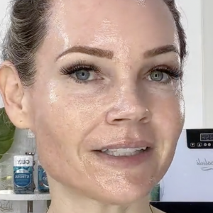 BIENPEEL 35 % TCA The No “Peel” Peel - treatment image