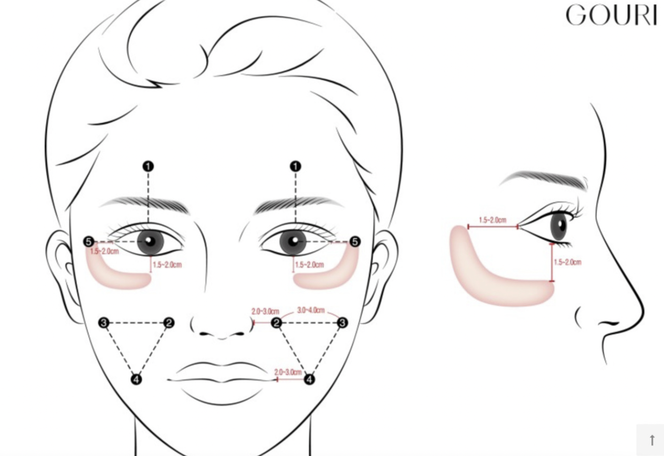 Gouri PCL and Hyafillia Lip Filler - treatment image