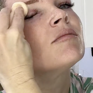 Fade Peel from Makeup Artists Choice - treatment image