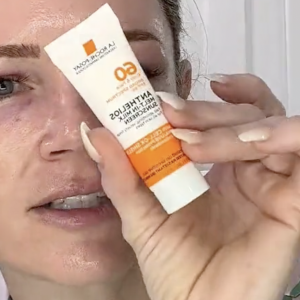 Fade Peel from Makeup Artists Choice - treatment image