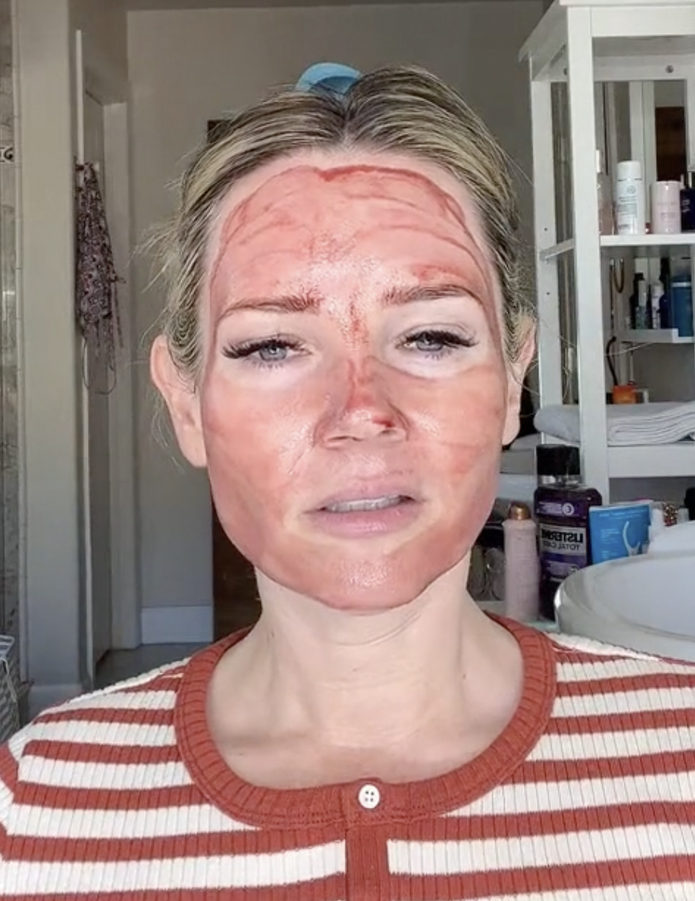 The Ordinary Exfoliating Peeling Solution - treatment image
