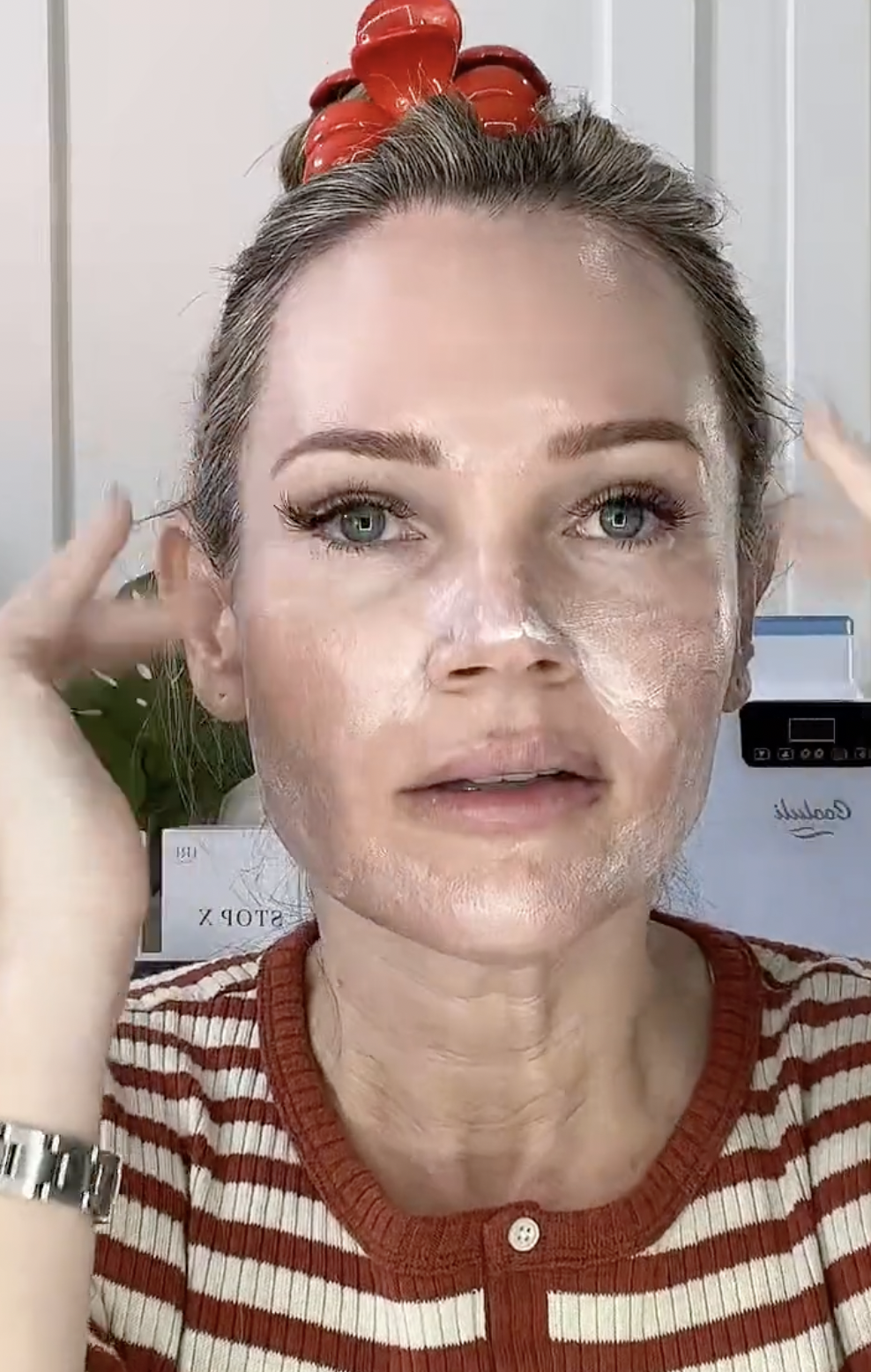 MICRONEEDLING WITH TRETINOIN NATURAL KAOS - treatment image