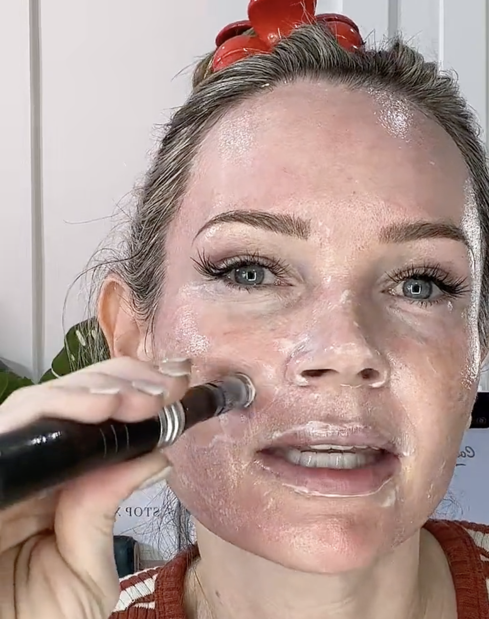 MICRONEEDLING WITH TRETINOIN NATURAL KAOS - treatment image