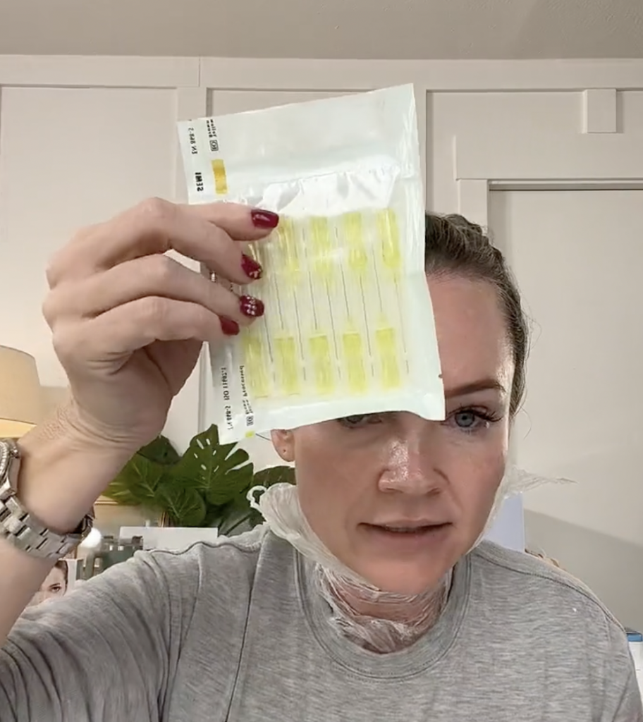 NECK REJUVENATION PCL THREADS AnD MESOTHERAPY