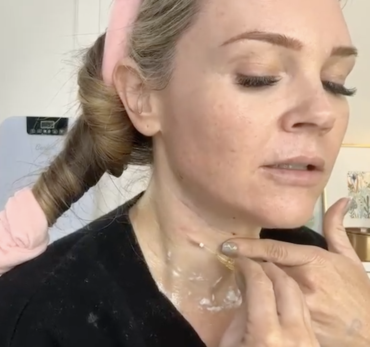REGENOVUE AQUASHINE AND PCL THREADS | NECK REJUVENATION - treatment image