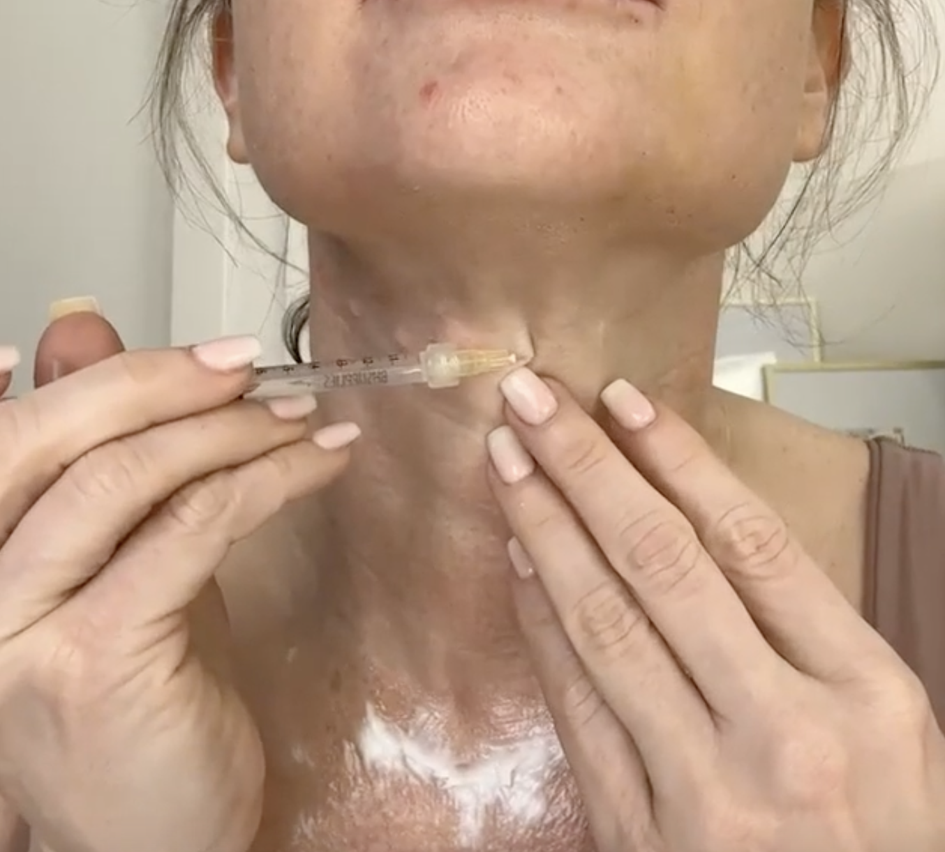 EXOXE EXOSOMES, QUEEN THREADS & CELLTERMI CLASSIC - treatment image
