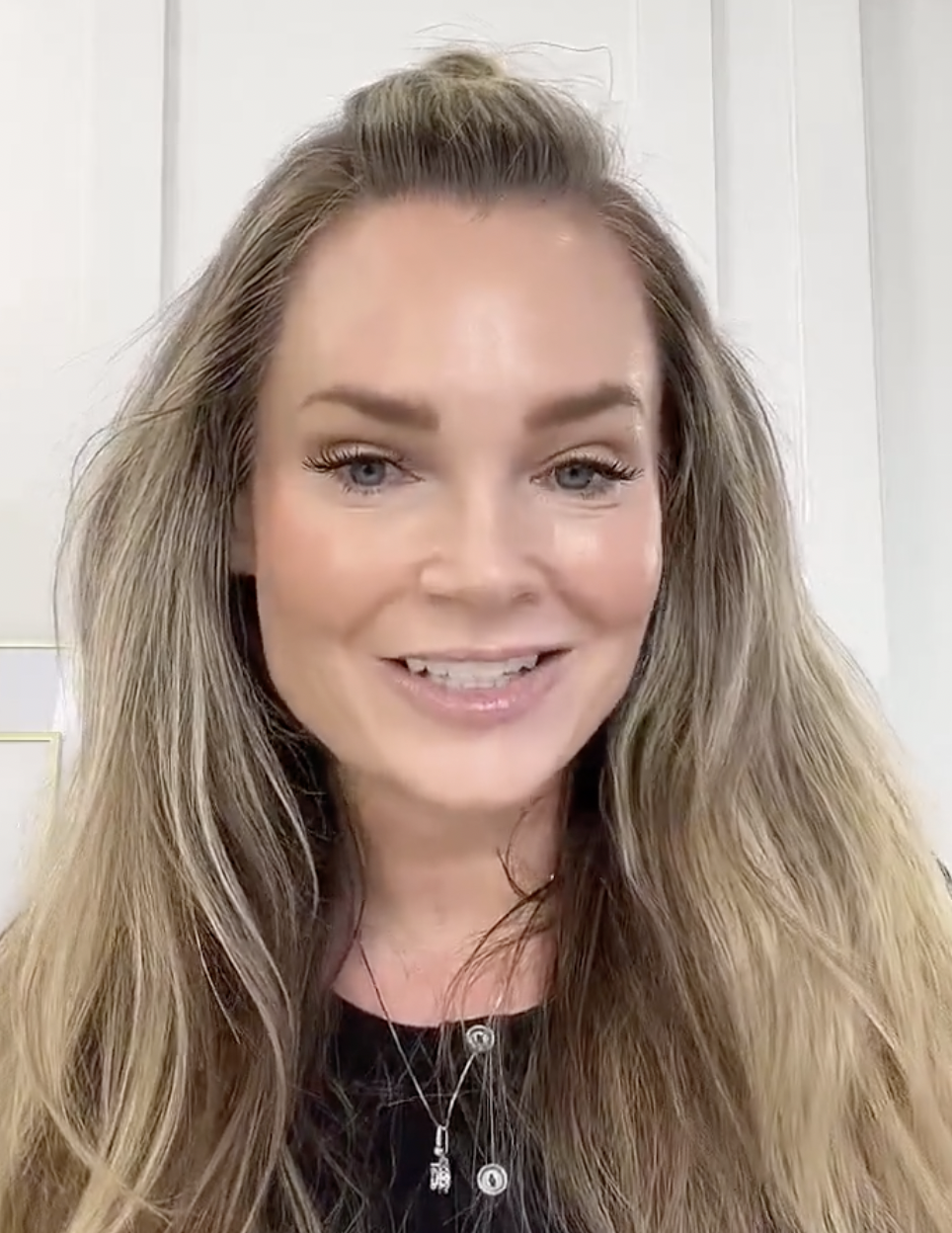 DERMAPLANING WITH EASYDEW - treatment image