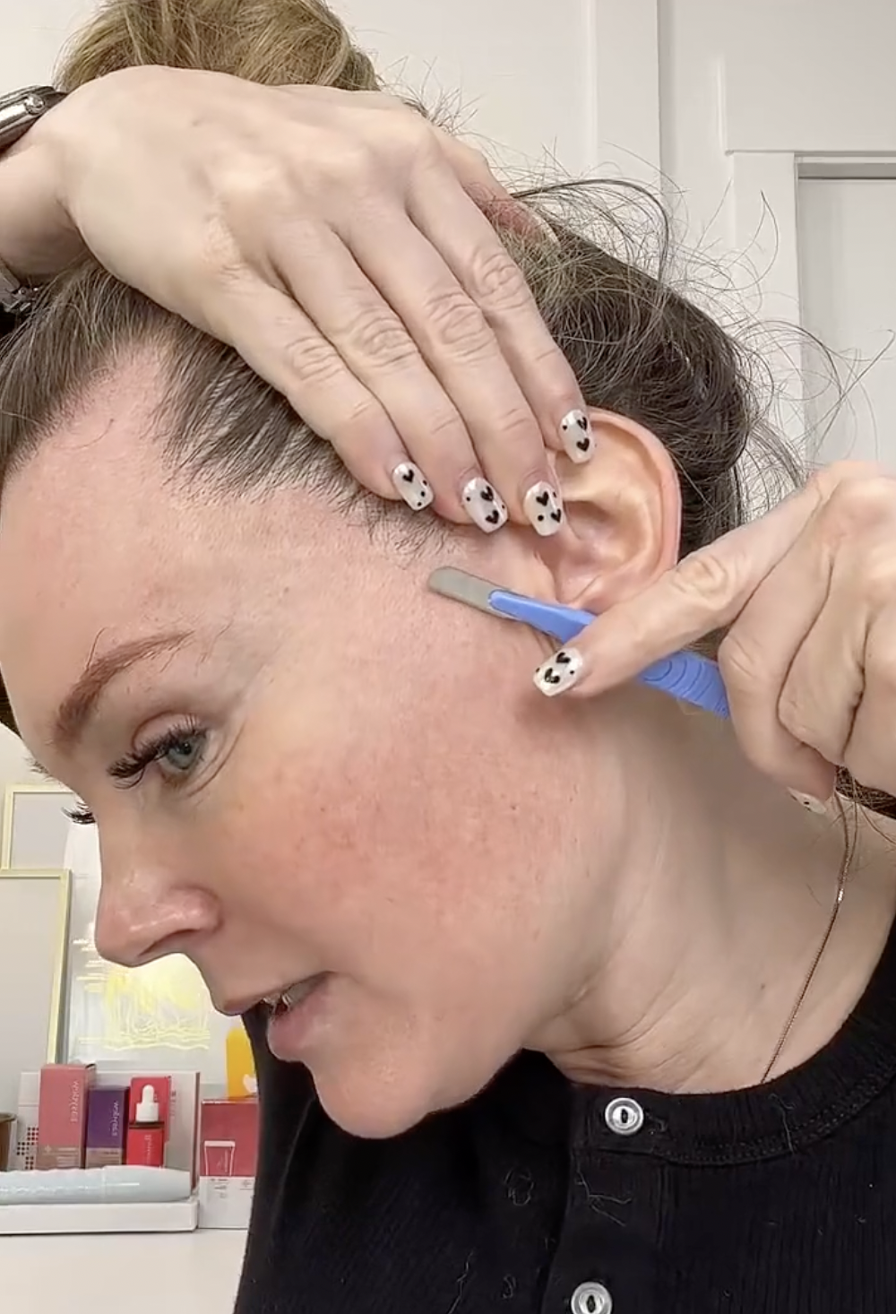 DERMAPLANING WITH EASYDEW