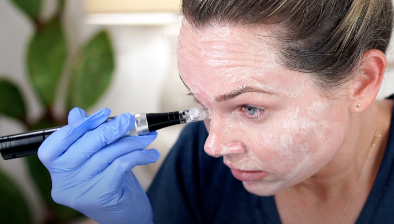 BB Glow TUTORIAL Treatment At HOME
