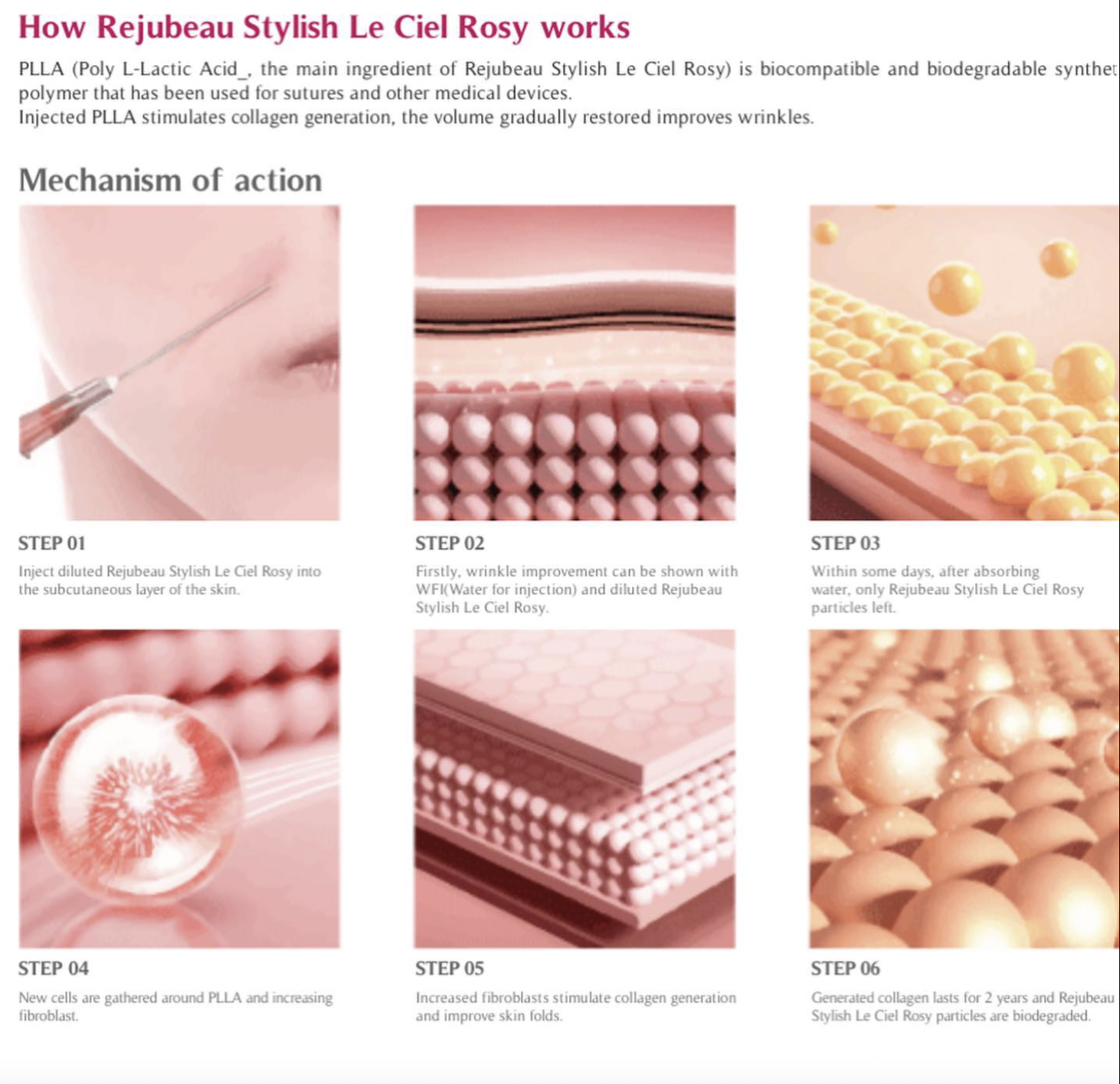Rejubeau Stylish Le Ciel Rosy | PLLA FILLER - treatment image