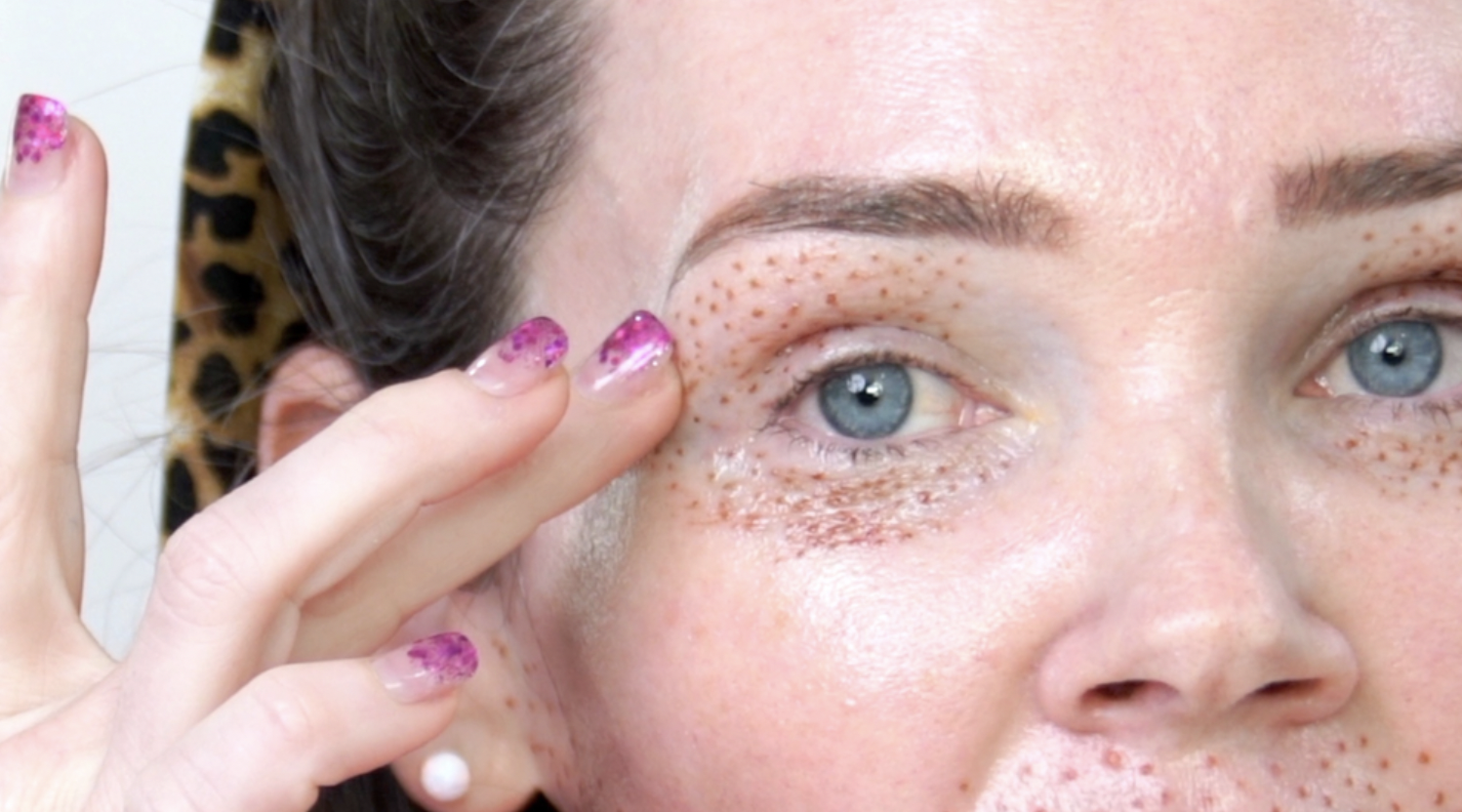 PLASMA FIBROBLAST EYES TREATMENT