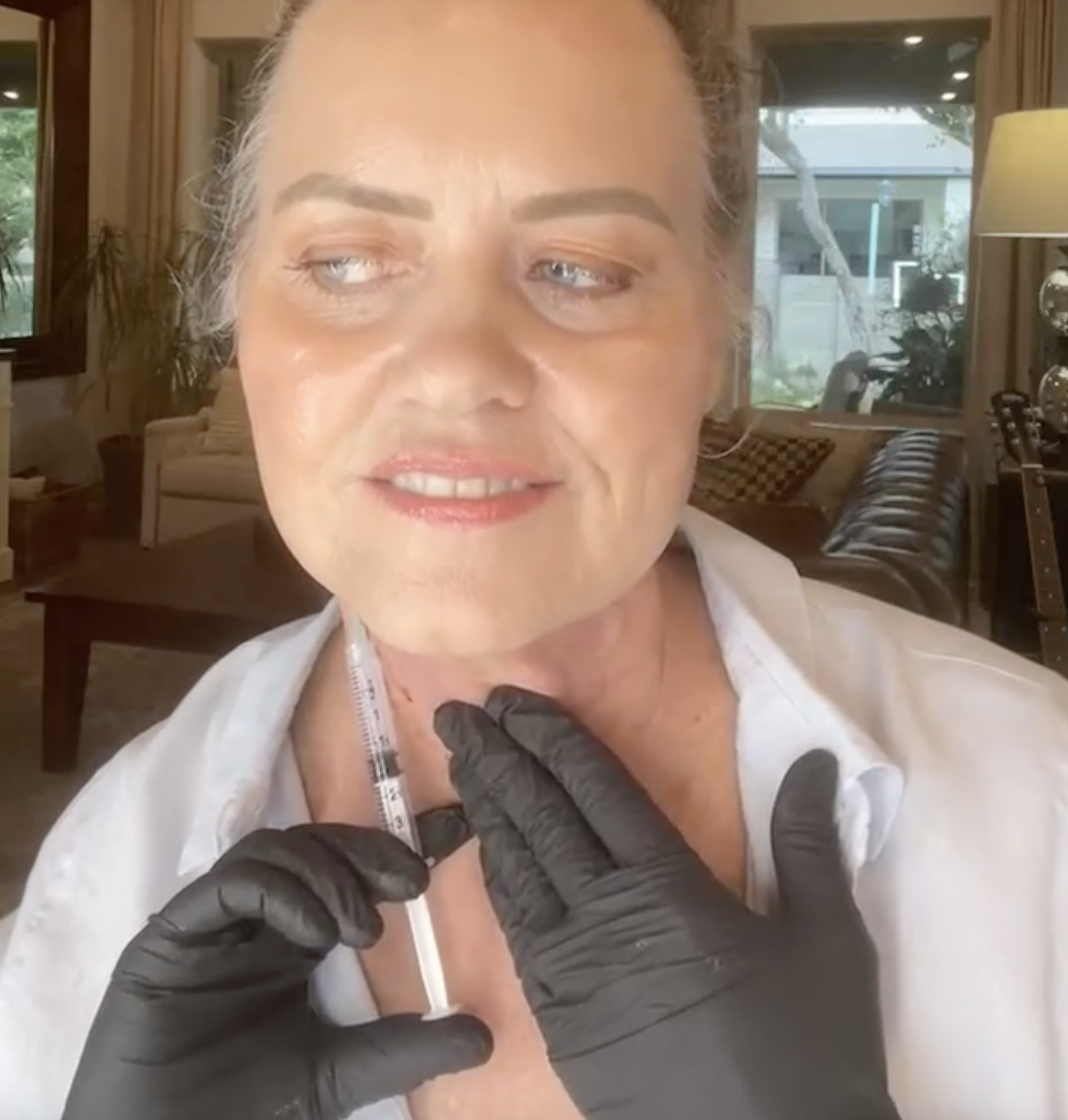 TOUCH UP MIRACLE LINE - treatment image