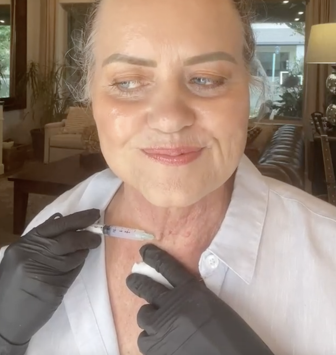 TOUCH UP MIRACLE LINE - treatment image