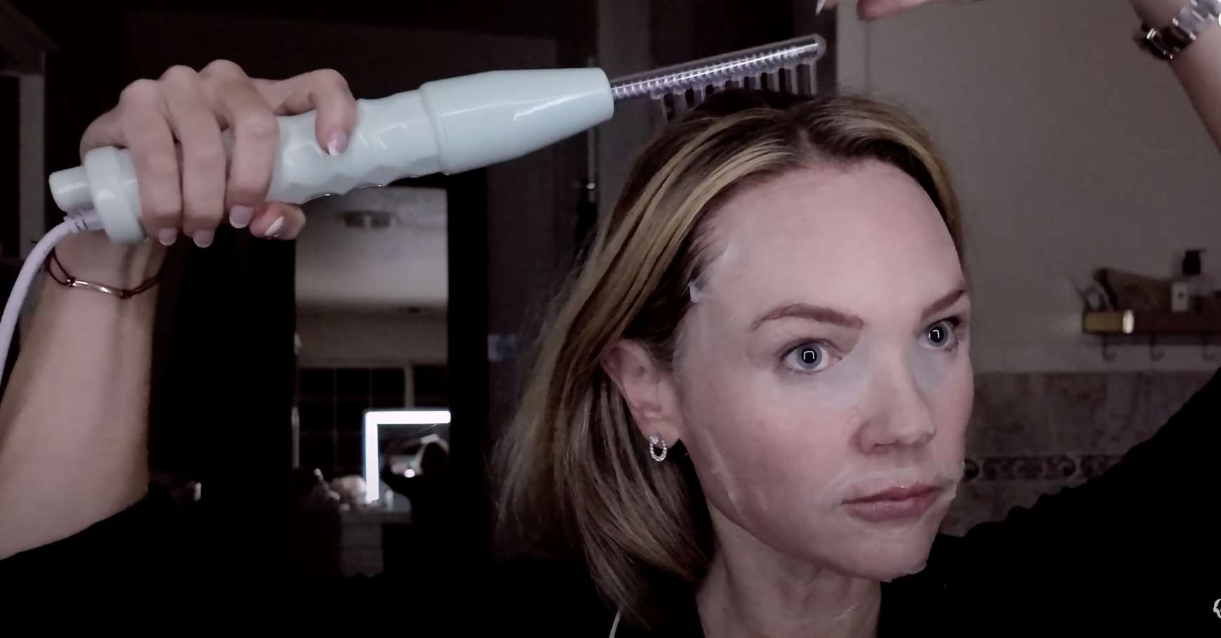 NUDERMA HIGH FREQUENCY WAND - treatment image