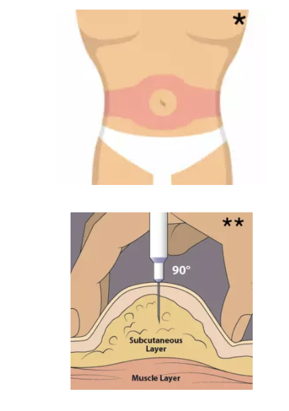 Melanotan II - treatment image