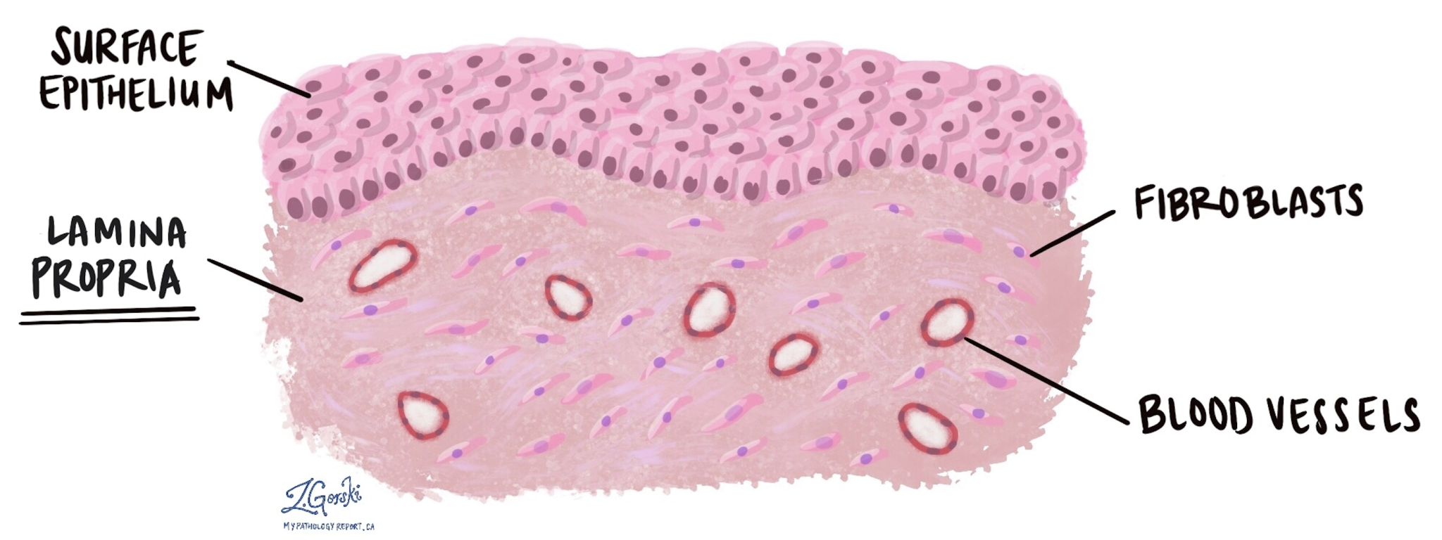 BPC157 + TB500: CAN THIS COMBO HEAL LEAKY GUT? - treatment image