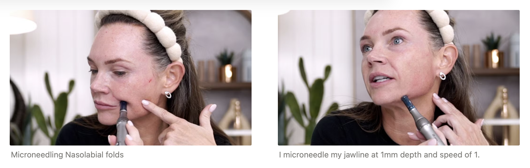 Microneedling with Curenex & DR Pen M8S: The Secret to Glowing, Youthful Skin - treatment image