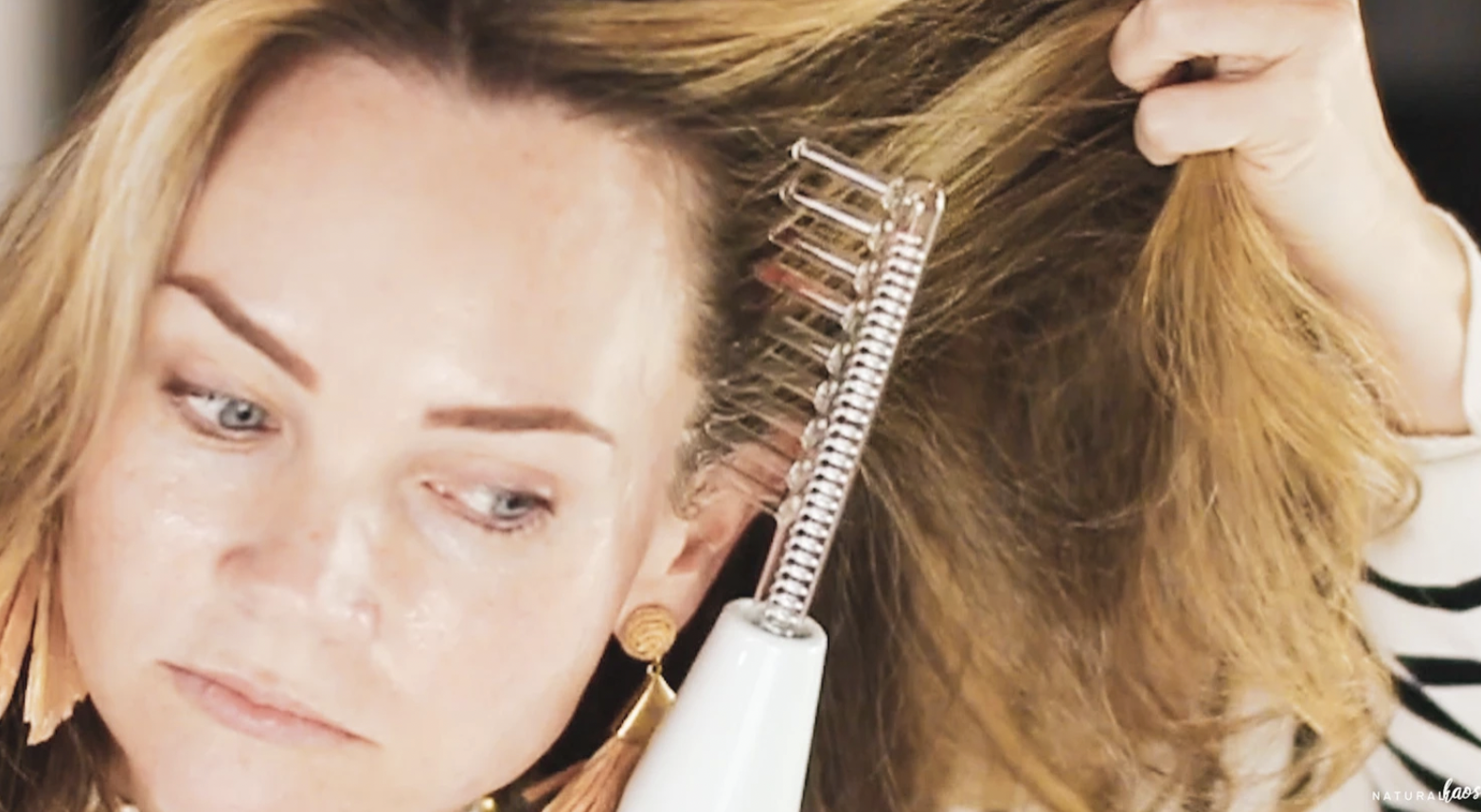 Semaglutide Hair Loss: What REALLY Helped My Hair Grow Back After 9 Months - treatment image