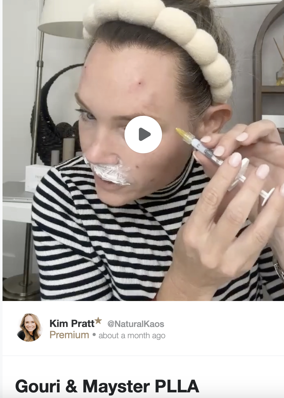 Biostimulators: How to Build Face Volume with Mayster PLLA & Gouri - treatment image