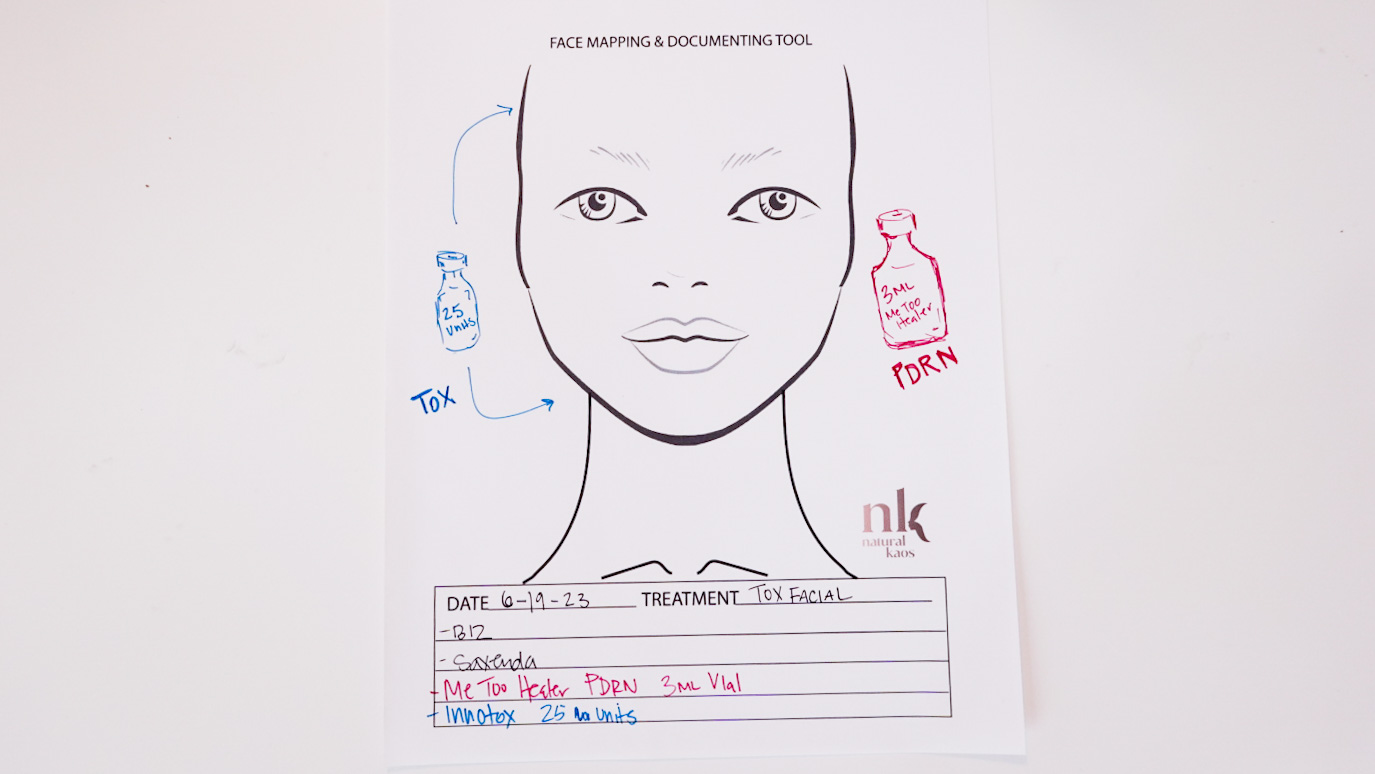 TOXIN FACIAL INNOTOX W/ METOO PDRN - treatment image