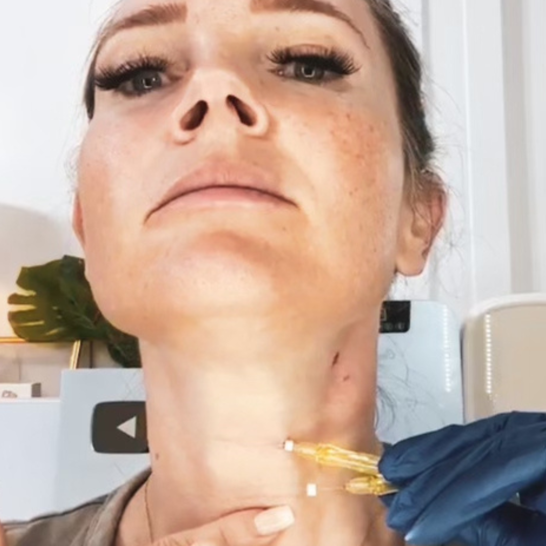 PCL MONO SCREW THREADS And KFDA Pro Skincare Unboxing