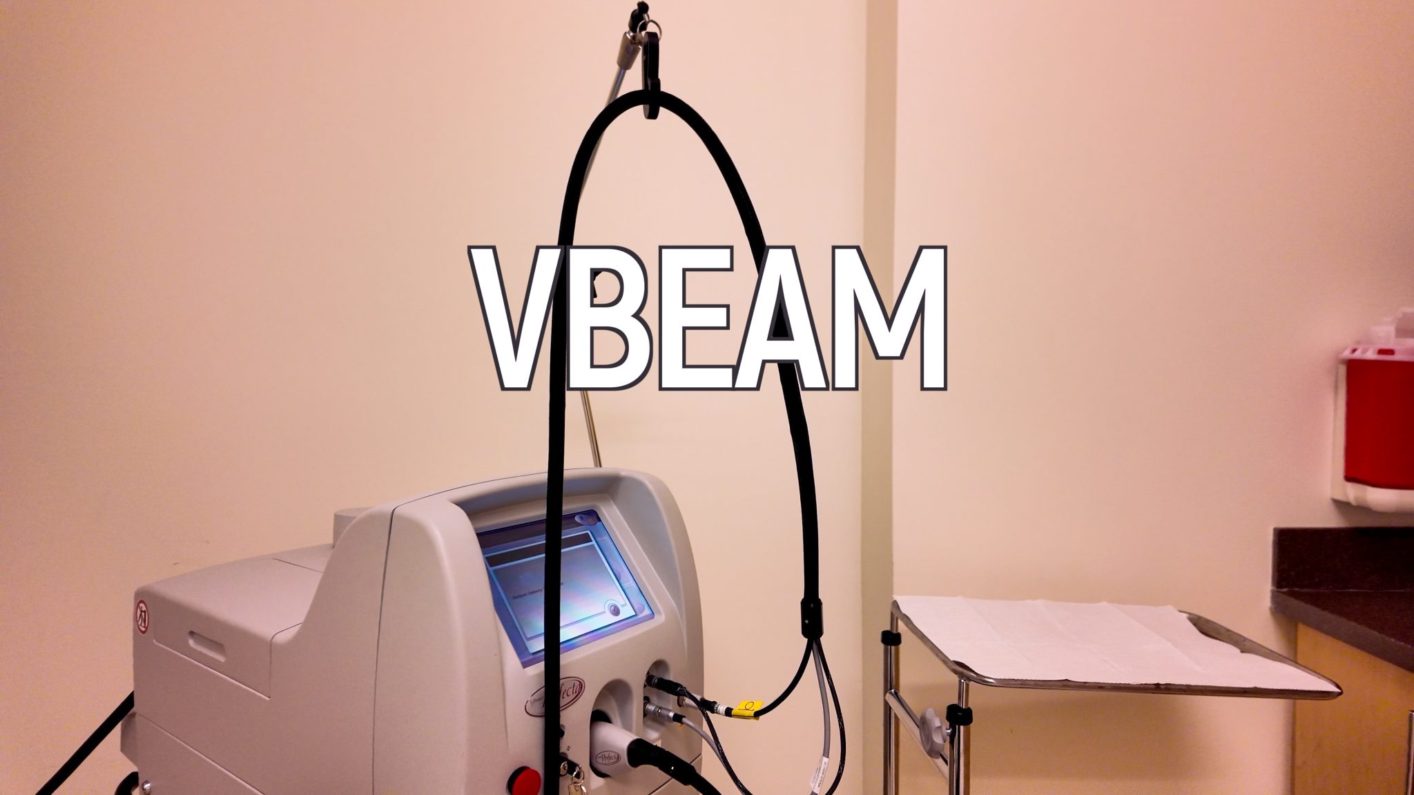 VBEAM LASER BEFORE AND AFTER