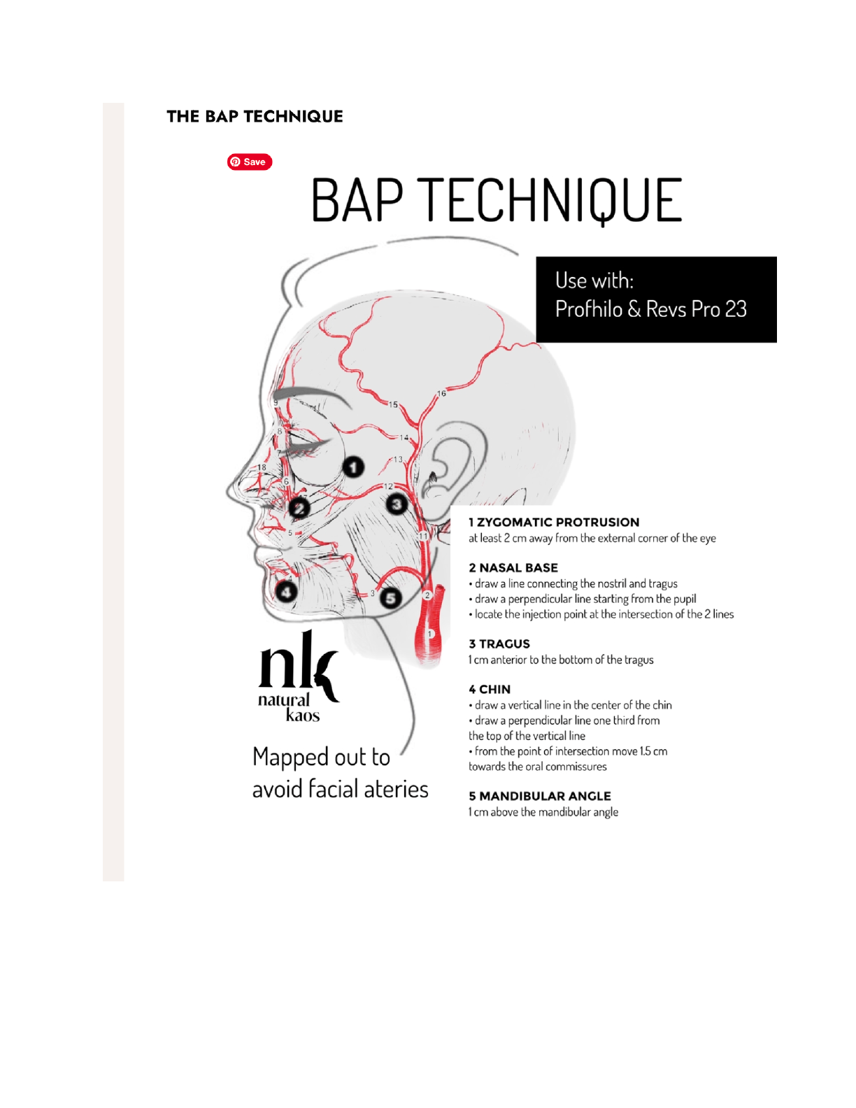 Preview of the Natural Kaos BAP Technique Guide