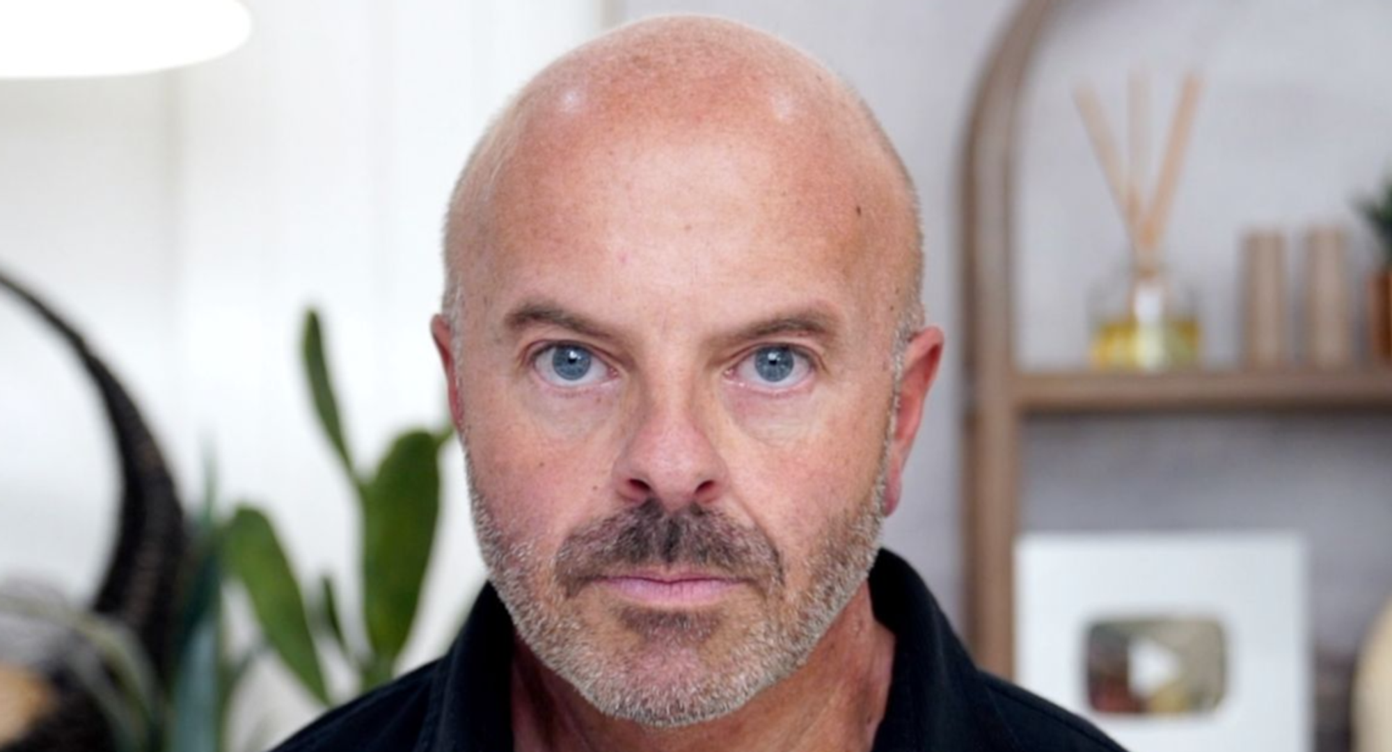 Brotox Breakdown: What You Need to Know About Botox for Guys - treatment image