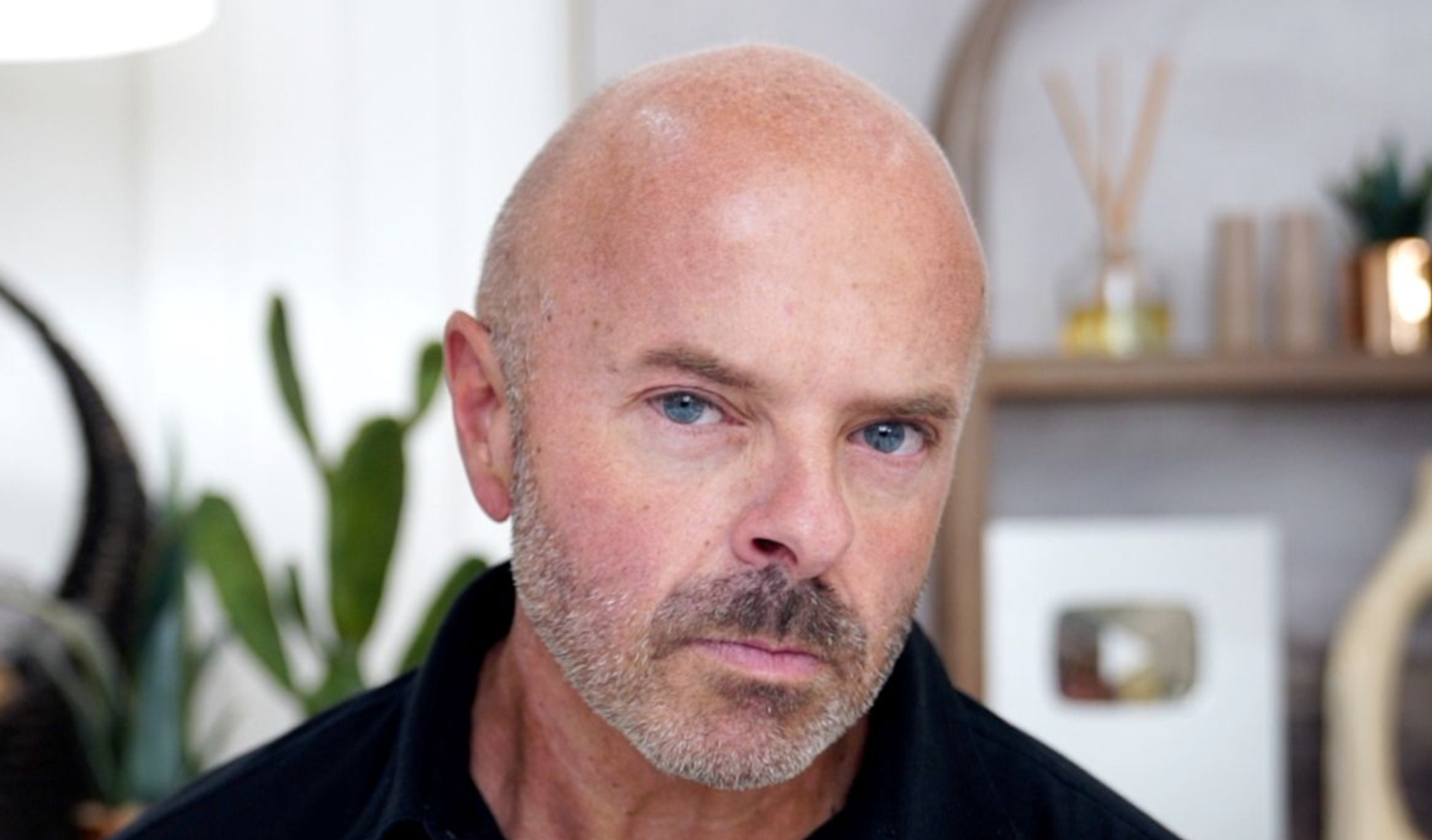 Brotox Breakdown: What You Need to Know About Botox for Guys - treatment image