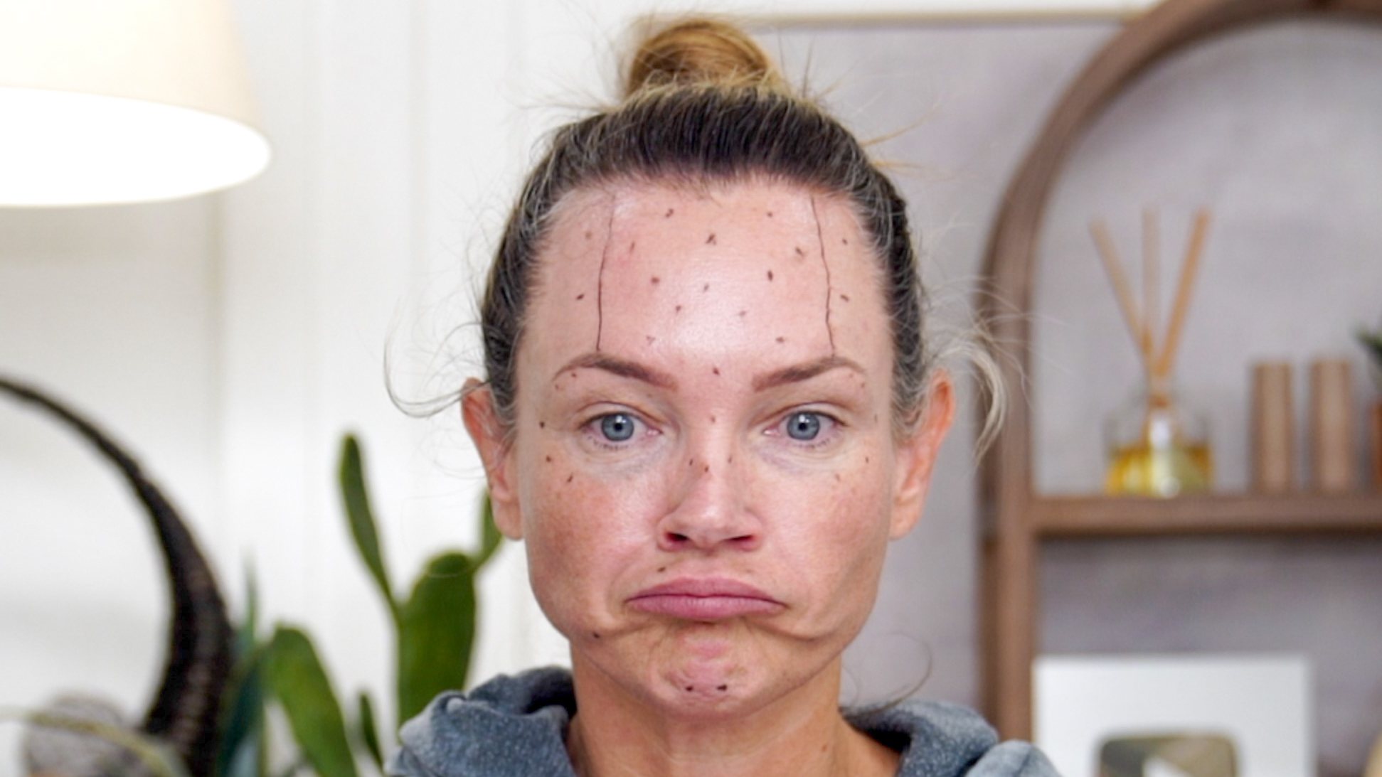 Transform Your Ozempic Face With Innotox And PLLA - treatment image