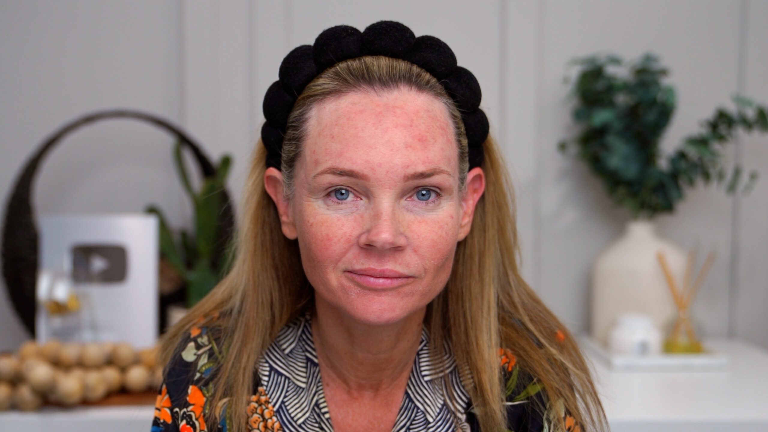 Kim Pratt documenting redness and early surface dryness on day 2 after facial microneedling