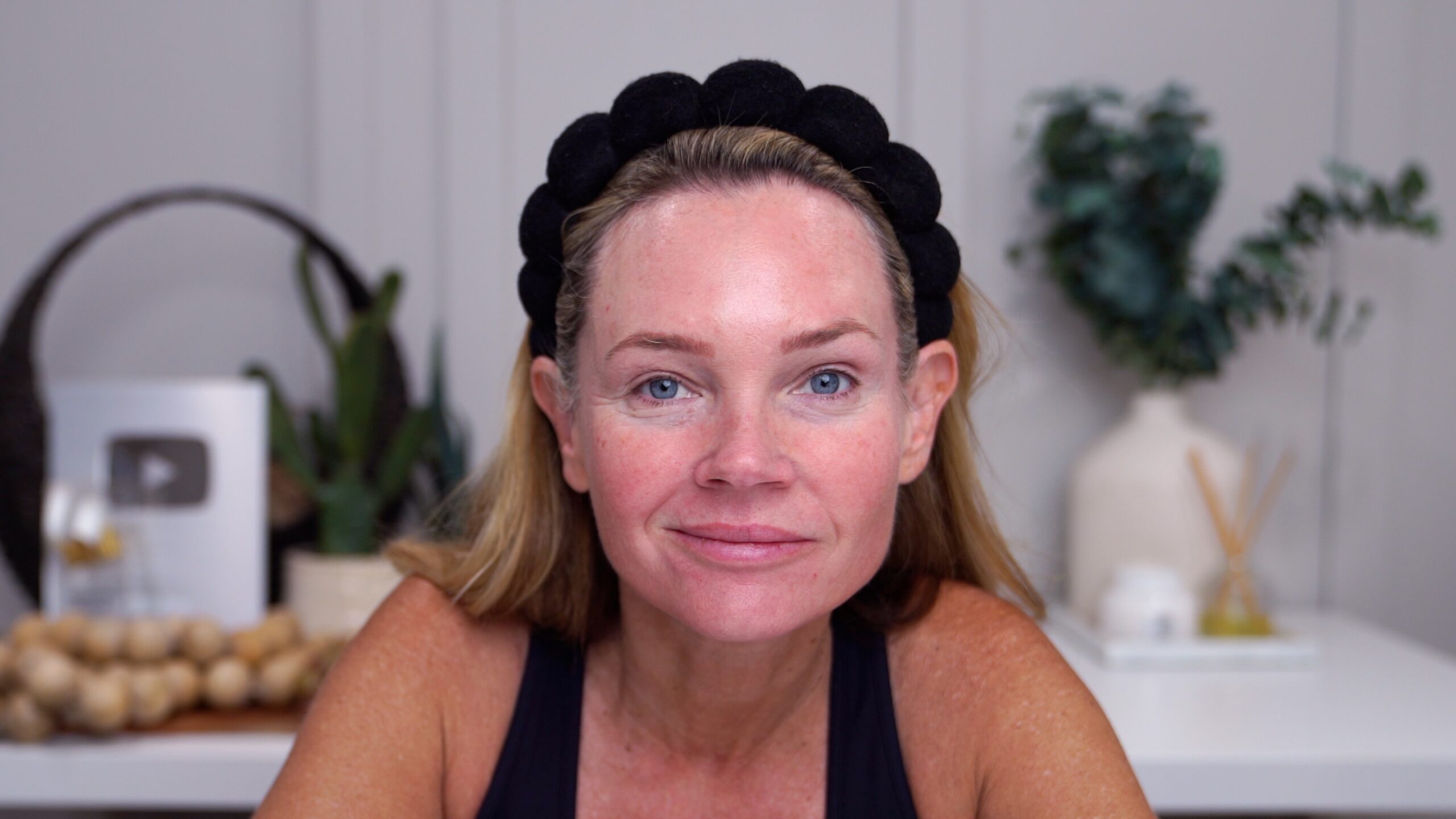 Kim Pratt showing calmer skin with reduced redness and flaking on day 5 after facial microneedling