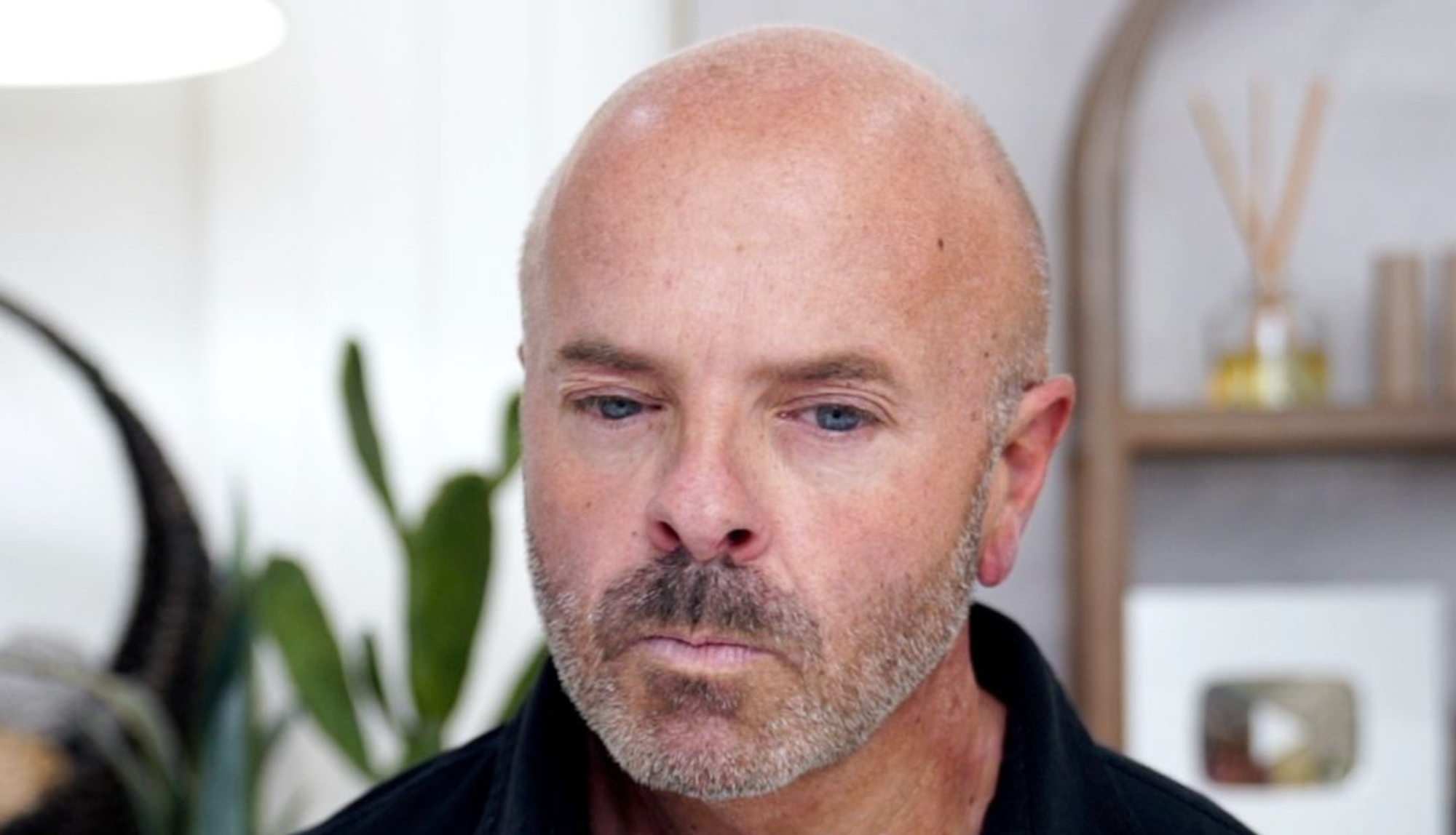 Brotox Breakdown: What You Need to Know About Botox for Guys - treatment image