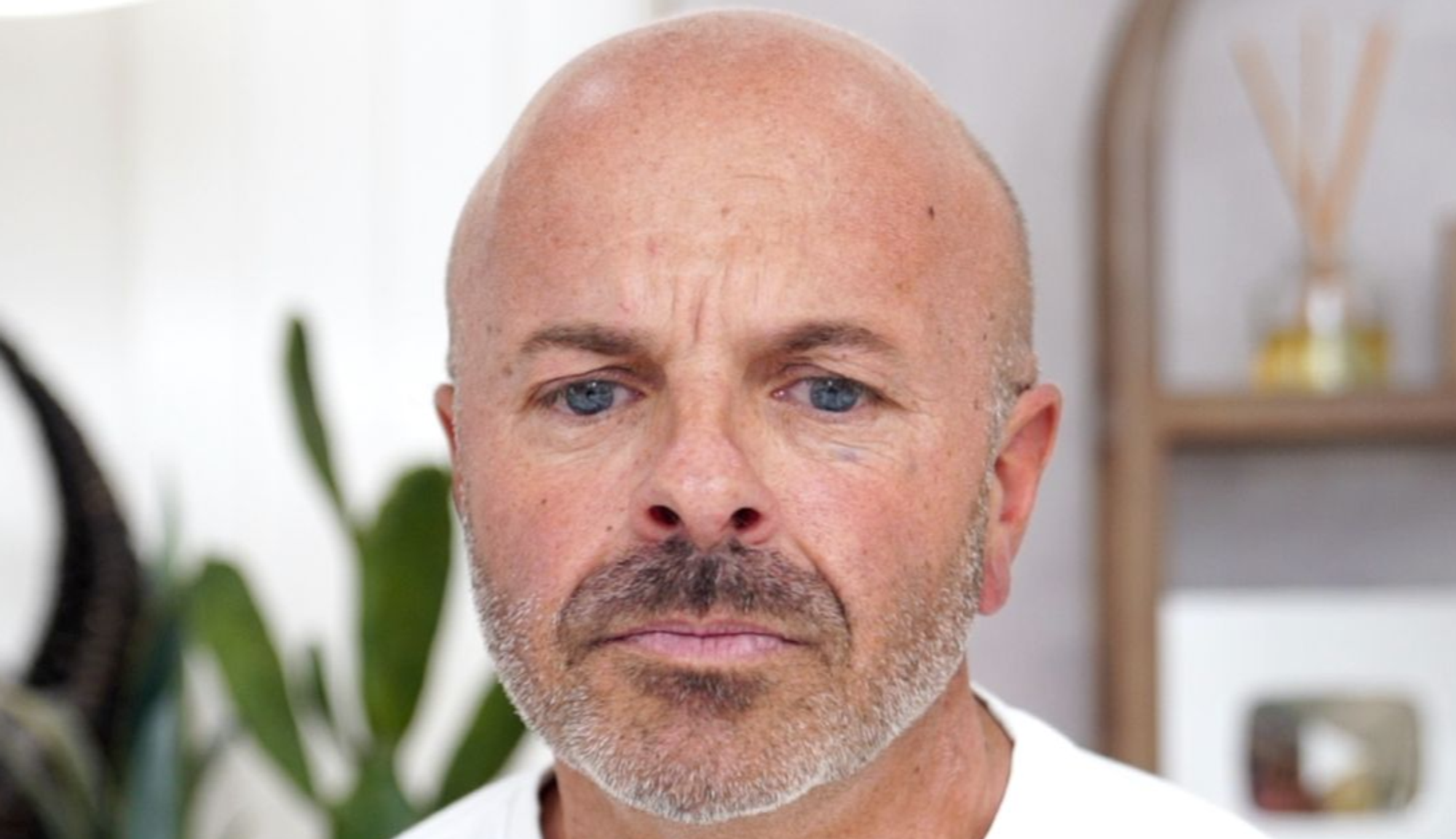 Brotox Breakdown: What You Need to Know About Botox for Guys - treatment image