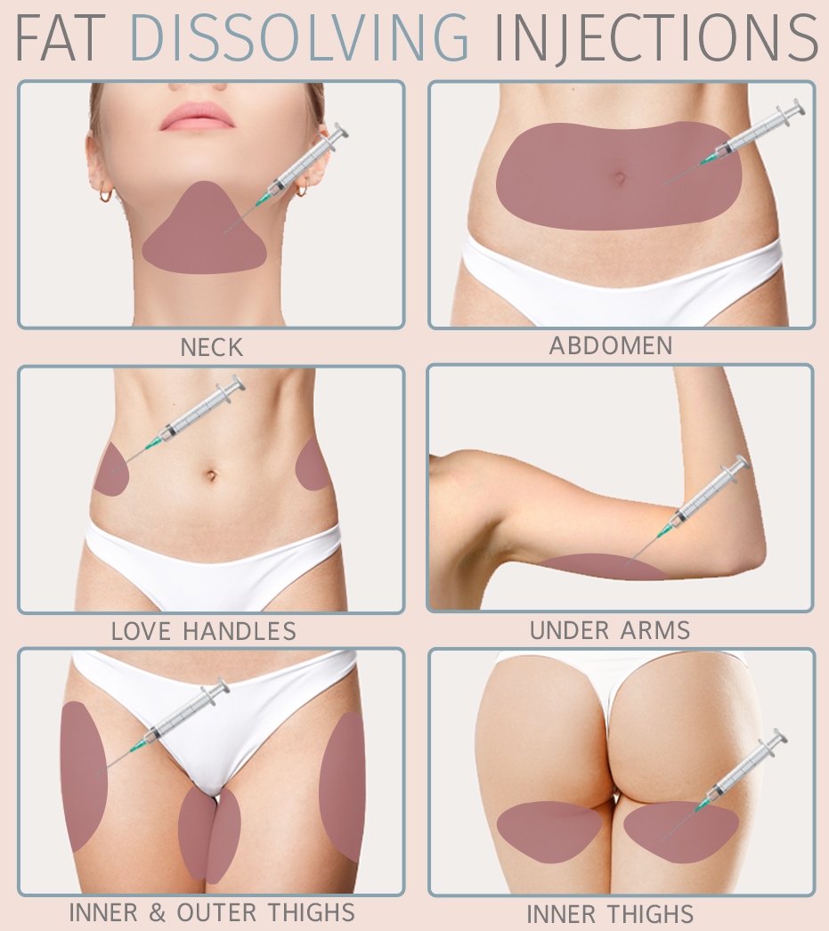 FAT DISSOLVERS | LIPOLYSIS INJECTIONS - treatment image