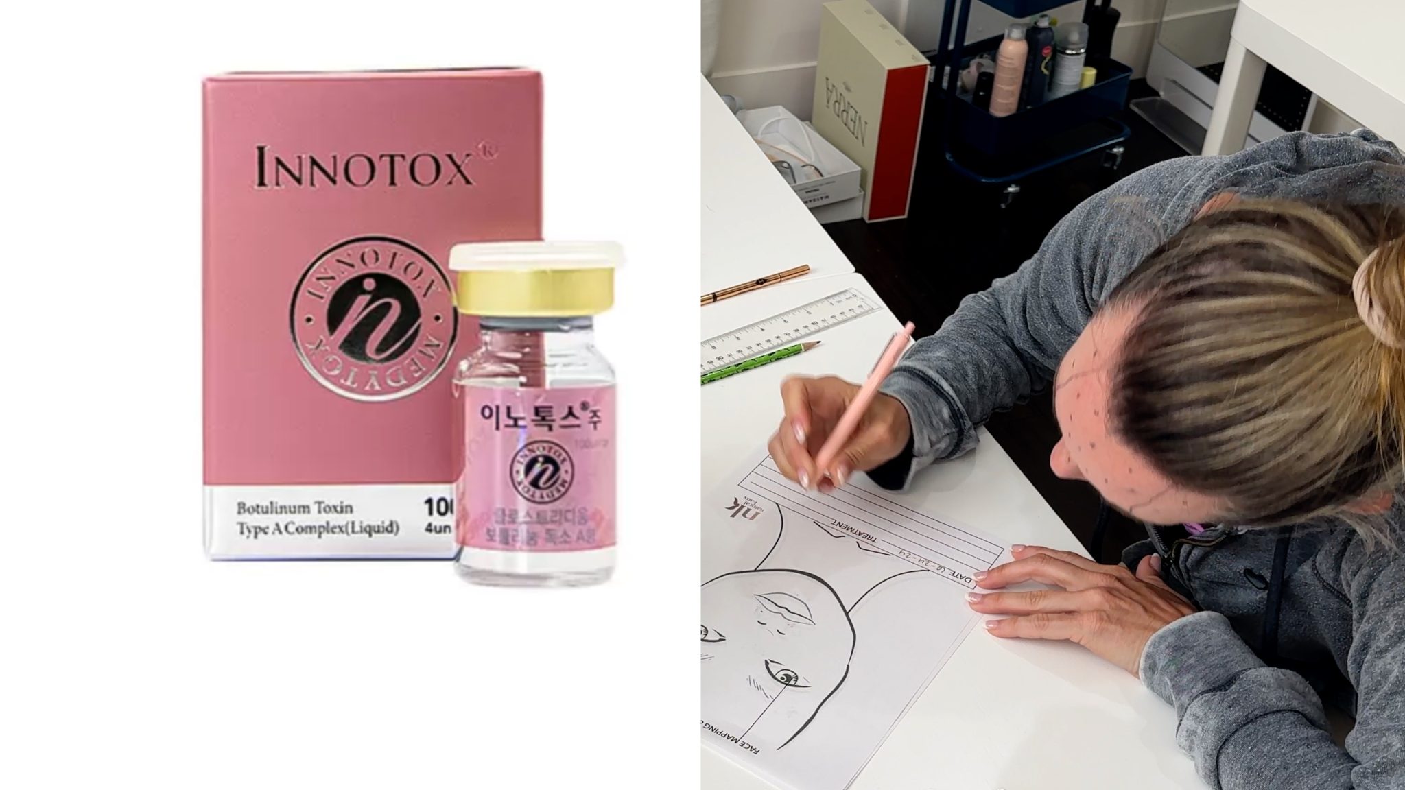 Transform Your Ozempic Face With Innotox And PLLA - treatment image