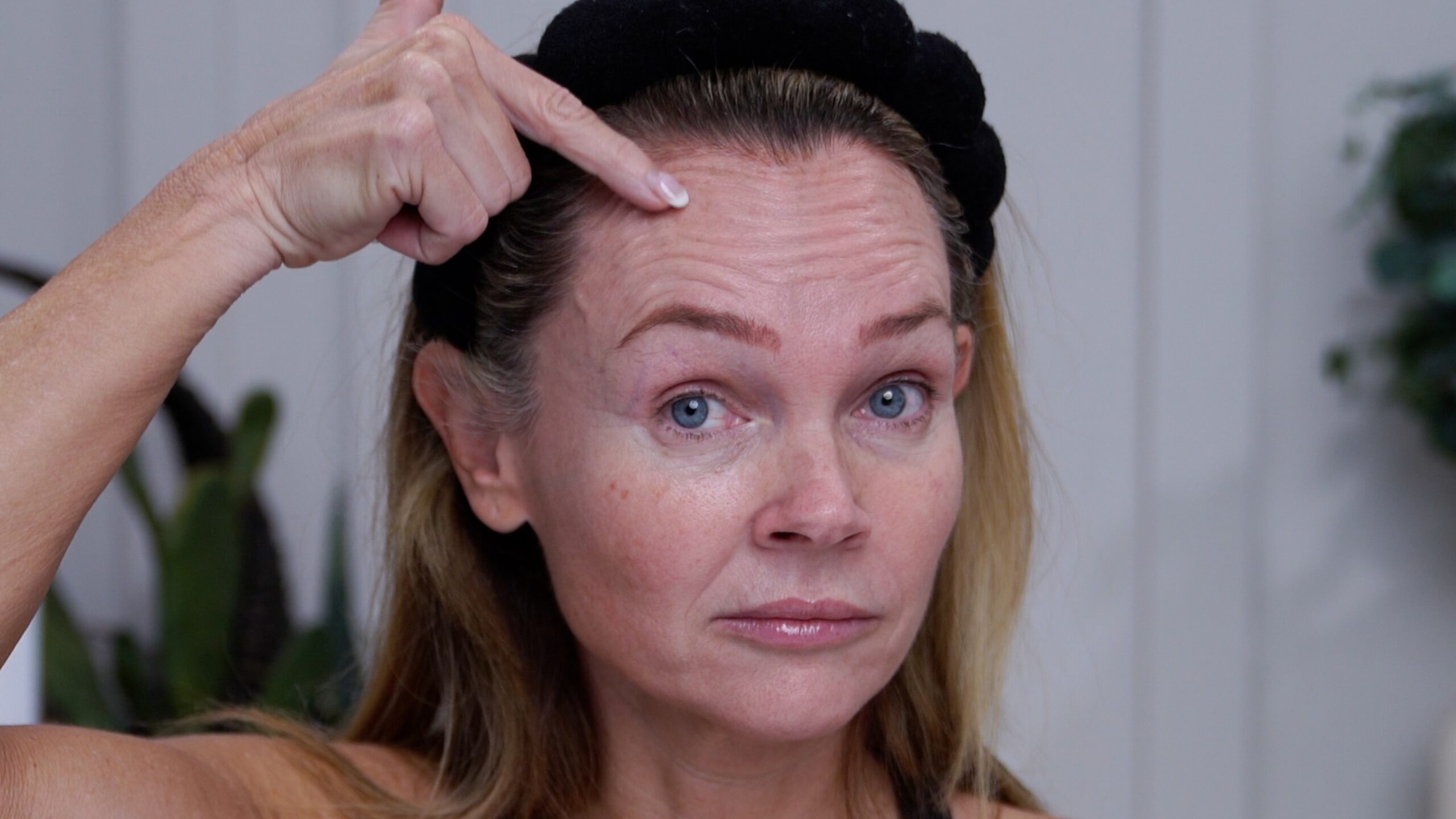 Kim Pratt pointing to forehead movement before her Russian Tox experiment