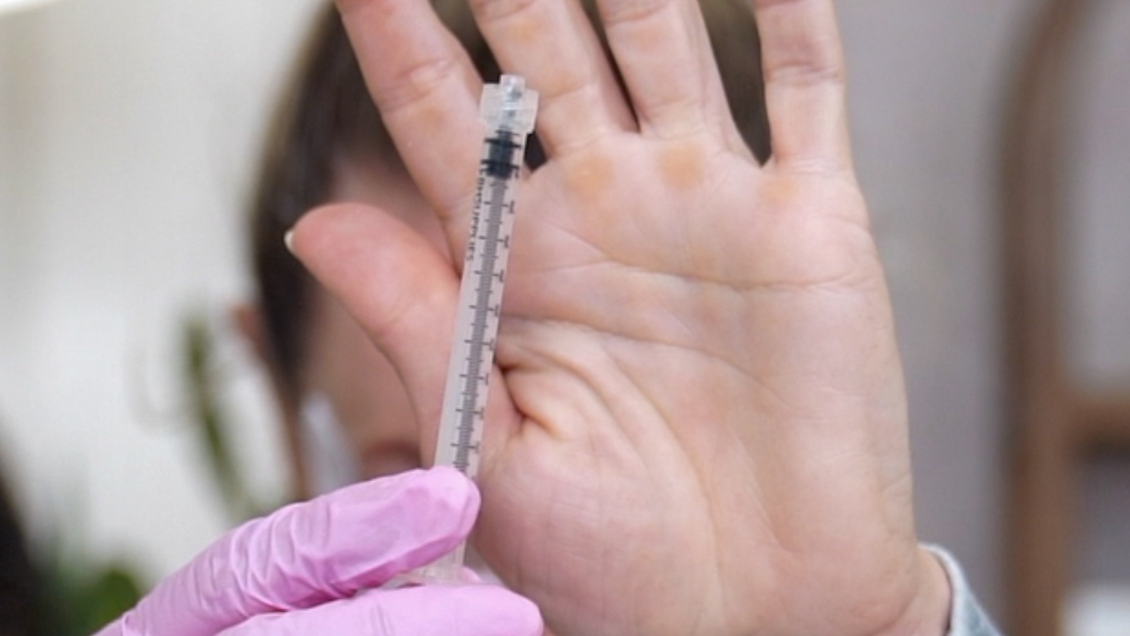 Transform Your Ozempic Face With Innotox And PLLA - treatment image