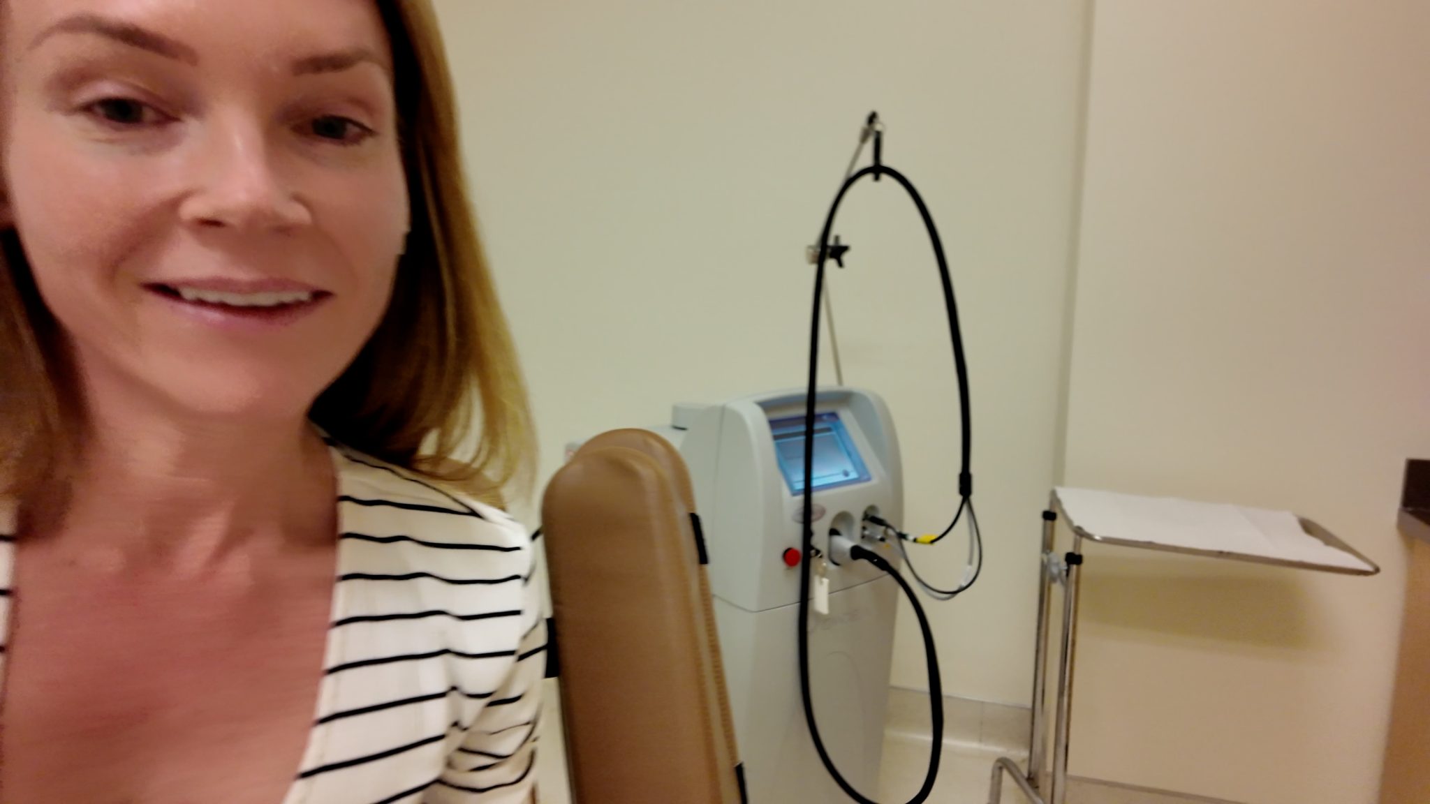 VBEAM LASER BEFORE AND AFTER - treatment image