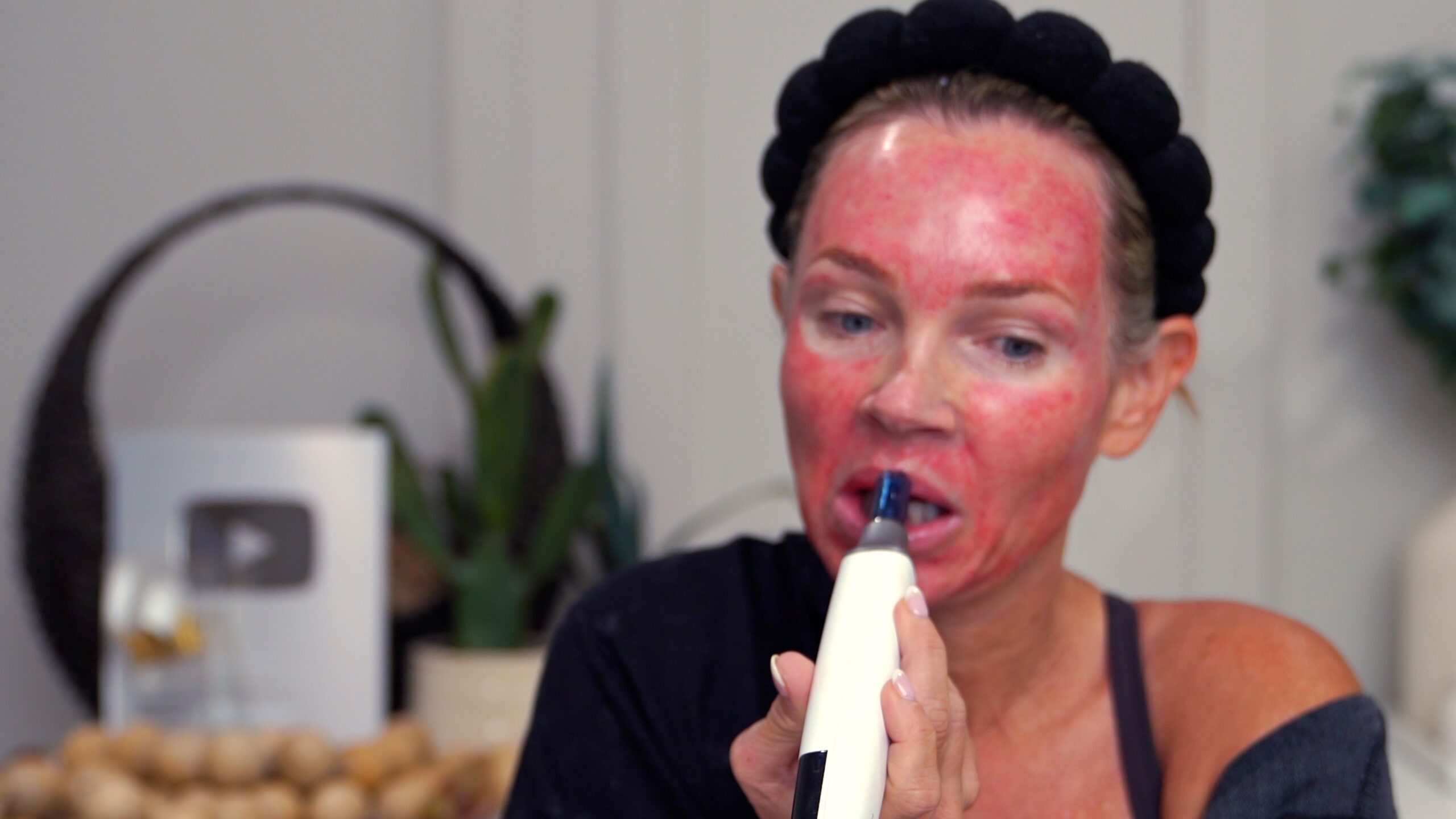 Kim Pratt using the Dr. Pen M9 around the lower face during her documented 1.6 mm facial microneedling treatment