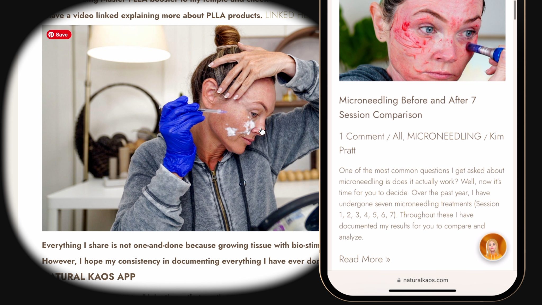 AI Meets Skincare: Discover the Mindos Bot I built to answer your skin Questions - treatment image