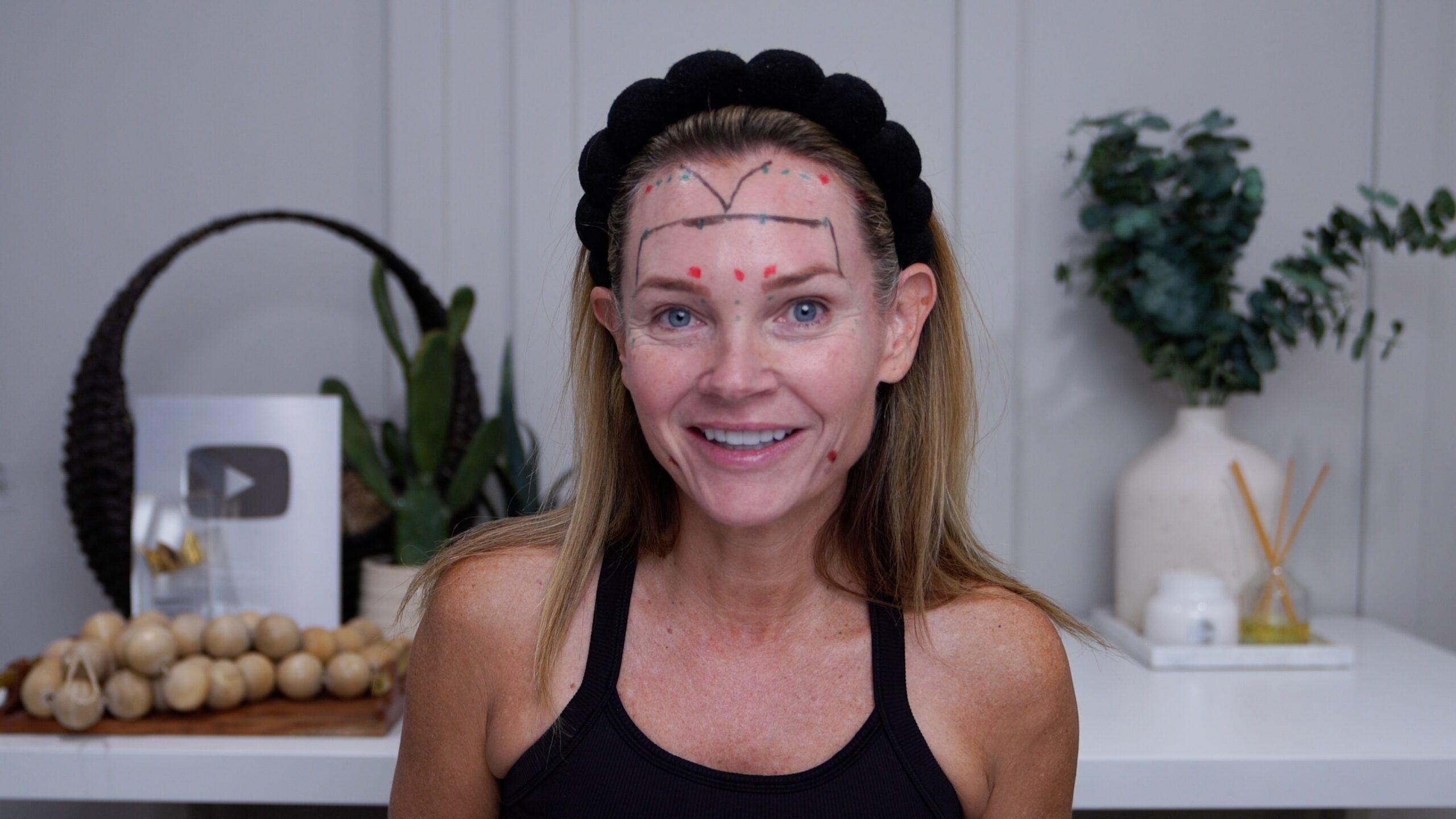 Kim Pratt with facial markings before documenting her Russian Tox treatment