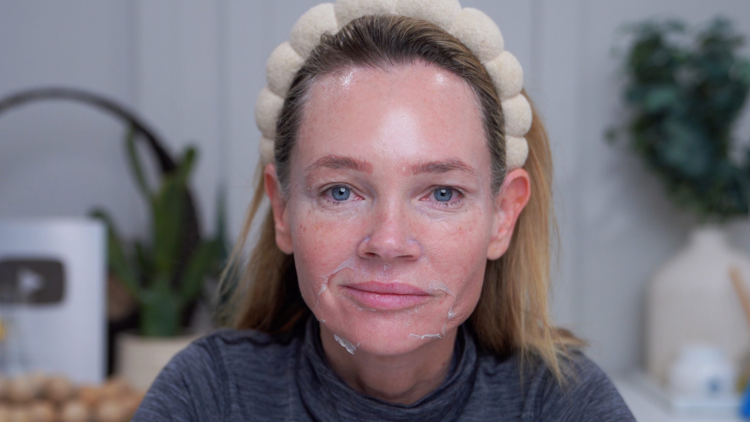 Day 3 with peeling around the mouth and chin